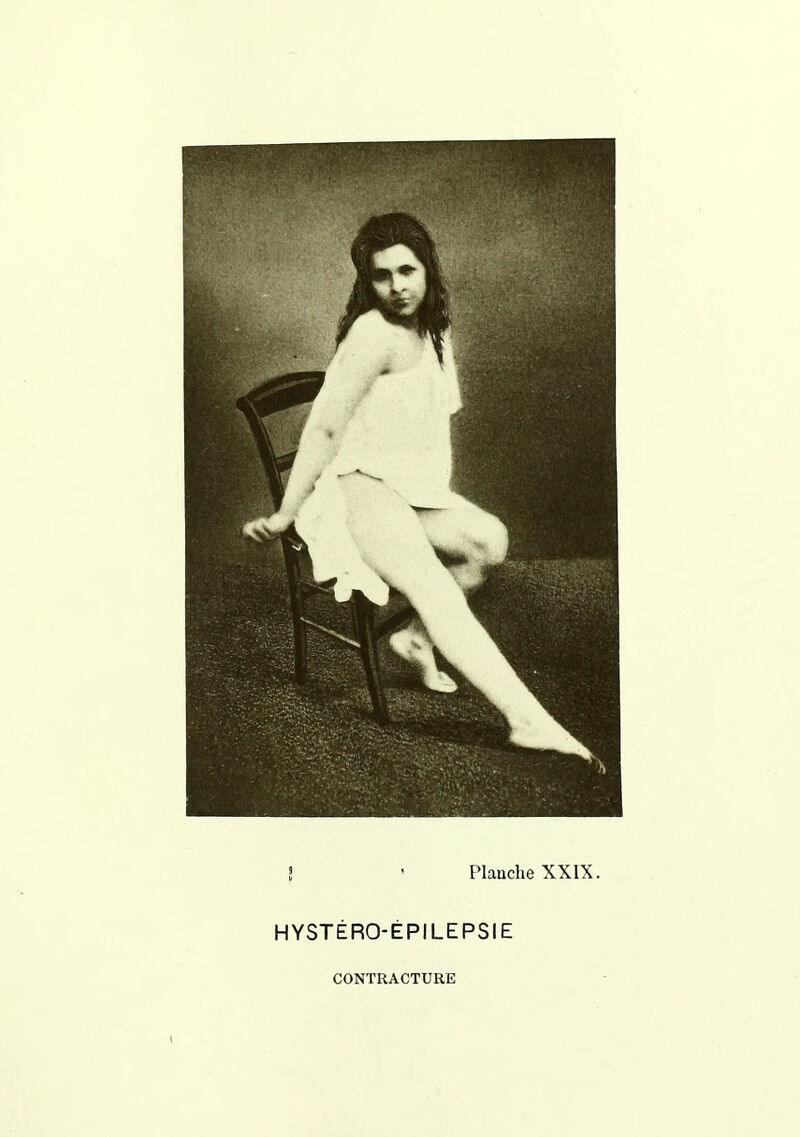 î • Planche XXIX. HYSTÉRO-ÉPILEPSIE CONTRACTURE