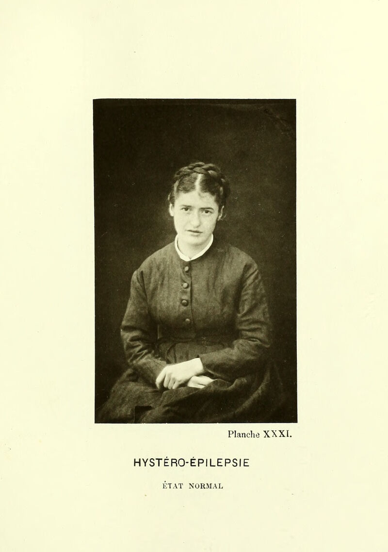 HYSTÉRO-ÉPILEPSIE ÉTAT NORMAL