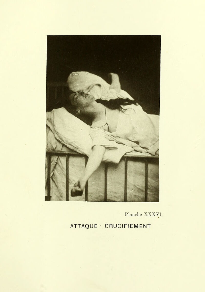 Flanelle XXXVl. ATTAQUE - CRUCIFIEMENT