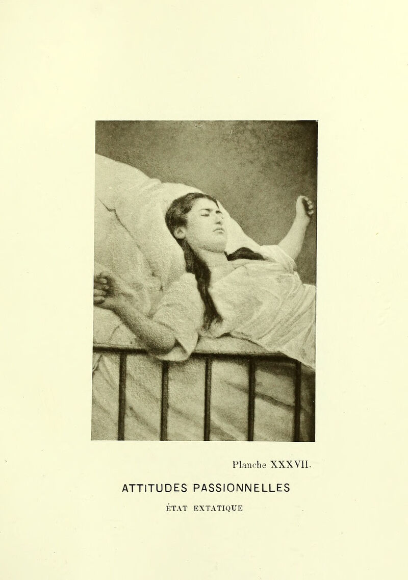 Plandie XXXVII. ATTITUDES PASSIONNELLES ÉTAT EXTATIQUE