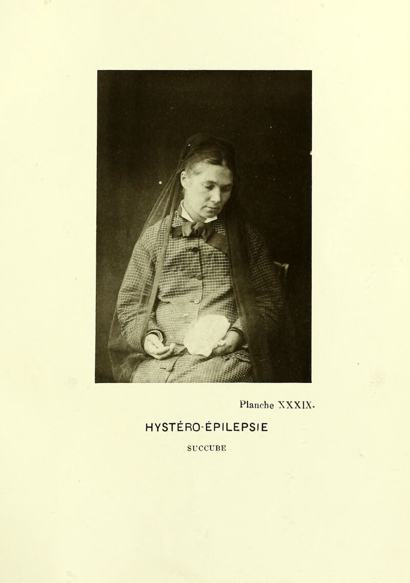 Planche XXXIX. HYSTÉRO-ÉPILEPSIE SL'CCUBE