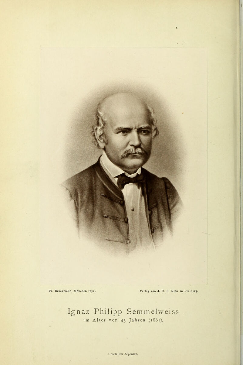 Ignaz Philipp Semmelweiss im Alter von 43 Jahren (1861). Gesetzlich deponirt.