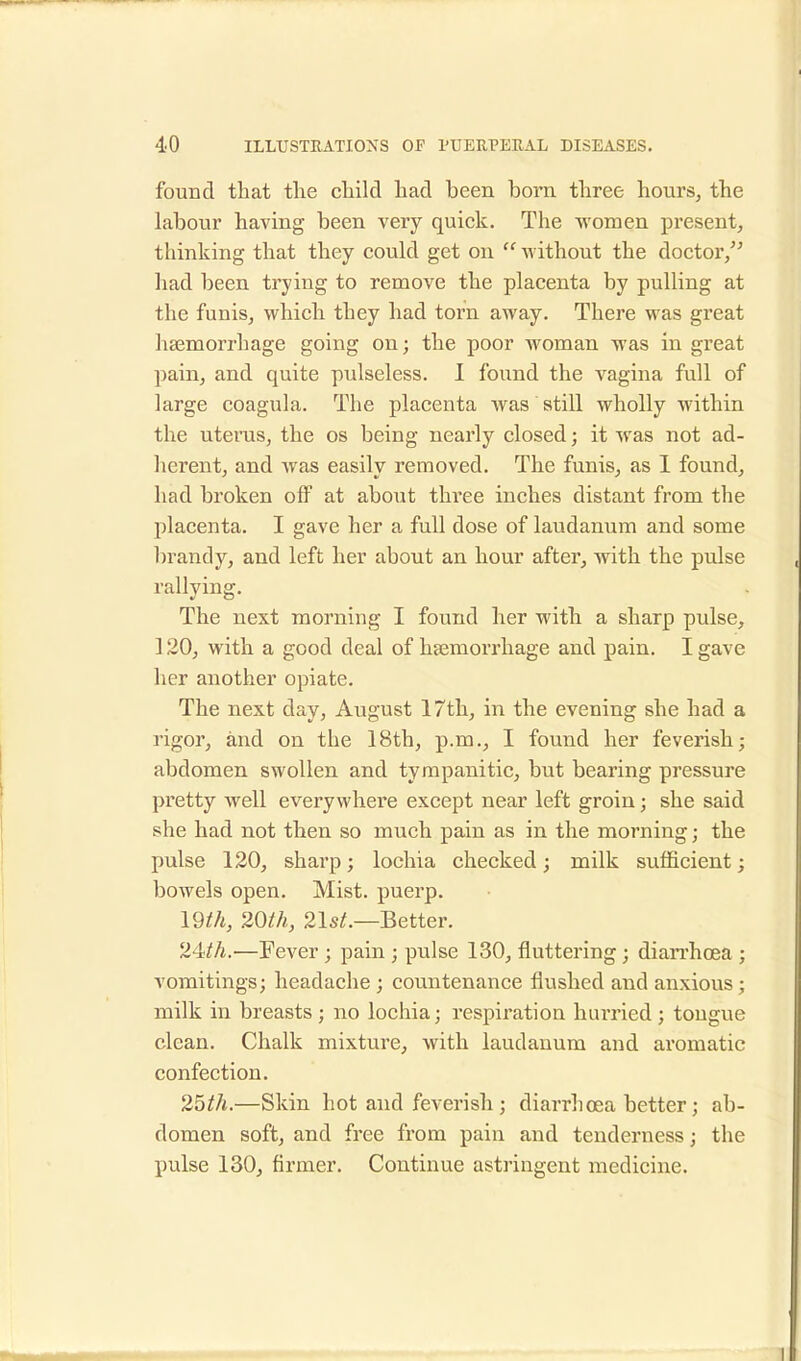 found that the child had been bora three hours, the labour having been very quick. The women present, thinking that they could get on  without the doctor/' had been trying to remove the placenta by pulling at the funis, which they had torn away. There was great haemorrhage going on; the poor woman was in great pain, and quite pulseless. I found the vagina full of large coagula. The placenta Avas still wholly within the uterus, the os being nearly closed; it was not ad- herent, and was easily removed. The funis, as I found, had broken off at about three inches distant from the placenta. I gave her a full dose of laudanum and some brandy, and left her about an hour after, with the pulse rallying. The next morning I found her with a sharp pulse, ] 20, with a good deal of hemorrhage and pain. I gave her another opiate. The next day, August 17th, in the evening she had a rigor, and on the 18th, p.m., I found her feverish; abdomen swollen and tympanitic, but bearing pressure pretty well everywhere except near left groin; she said she had not then so much pain as in the morning; the pulse 120, sharp; lochia checked; milk sufficient; bowels open. Mist, puerp. 19th, 20th, 21st.—Better. 24//i.—Fever ; pain ; pulse 130, fluttering ; diarrhoea ; vomitings; headache ; countenance flushed and anxious; milk in breasts ; no lochia; respiration hurried ; tongue clean. Chalk mixture, with laudanum and aromatic confection. 25th.—Skin hot and feverish ; diarrhoea better; ab- domen soft, and free from pain and tenderness; the pulse 130, firmer. Continue astringent medicine.