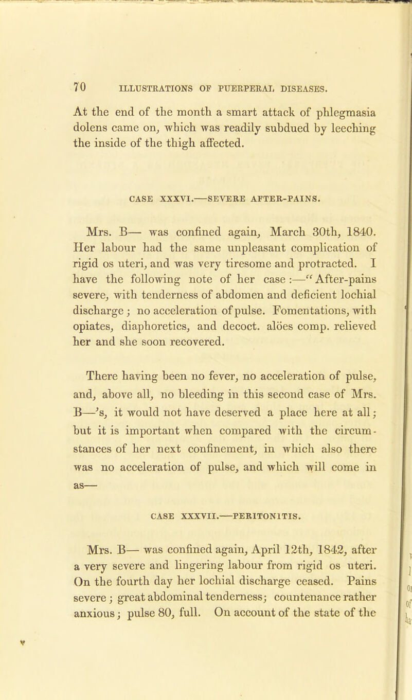At the end of the month a smart attack of phlegmasia dolens came on, which was readily subdued by leeching the inside of the thigh affected. CASE XXXVI. SEVERE AFTER-PAINS. Mrs. B— was confined again, March 30th, 1840. Her labour had the same unpleasant complication of rigid os uteri, and was very tiresome and protracted. I have the following note of her case :— After-pains severe, with tenderness of abdomen and deficient lochial discharge ; no acceleration of pulse. Fomentations, with opiates, diaphoretics, and decoct, aloes comp. relieved her and she soon recovered. There having been no fever, no acceleration of pulse, and, above all, no bleeding in this second case of Mrs. B—'s, it would not have deserved a place here at all; but it is important when compared with the circum - stances of her next confinement, in which also there was no acceleration of pulse, and which will come in as— CASE XXXVII. PERITONITIS. Mrs. B— was confined again, April 12th, 1842, after a very severe and lingering labour from rigid os uteri. On the fourth day her lochial discharge ceased. Pains severe; great abdominal tenderness; countenance rather anxious; pulse 80, full. On account of the state of the