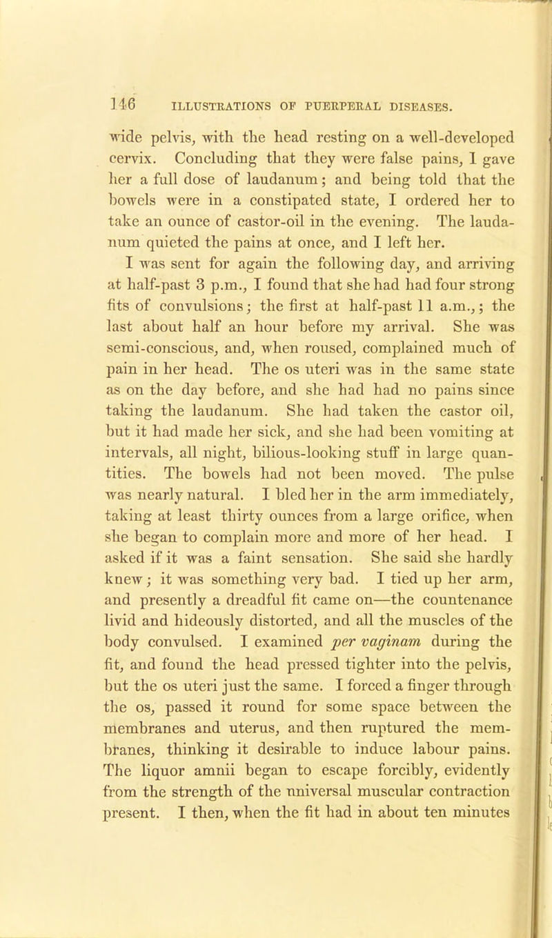 wide pelvis, with the head resting on a well-developed cervix. Concluding that they were false pains, 1 gave her a full dose of laudanum; and being told that the bowels were in a constipated state, I ordered her to take an ounce of castor-oil in the evening. The lauda- num quieted the pains at once, and I left her. I was sent for again the following day, and arriving at half-past 3 p.m., I found that she had had four strong fits of convulsions; the first at half-past 11 a.m.,; the last about half an hour before my arrival. She was semi-conscious, and, when roused, complained much of pain in her head. The os uteri was in the same state as on the day before, and she had had no pains since taking the laudanum. She had taken the castor oil, but it had made her sick, and she had been vomiting at intervals, all night, bilious-looking stuff in large quan- tities. The bowels had not been moved. The pulse was nearly natural. I bled her in the arm immediately, taking at least thirty ounces from a large orifice, when she began to complain more and more of her head. I asked if it was a faint sensation. She said she hardly knew; it was something very bad. I tied up her arm, and presently a dreadful fit came on—the countenance livid and hideously distorted, and all the muscles of the body convulsed. I examined per vaginam during the fit, and found the head pressed tighter into the pelvis, but the os uteri just the same. I forced a finger through the os, passed it round for some space between the membranes and uterus, and then ruptured the mem- branes, thinking it desirable to induce labour pains. The liquor amnii began to escape forcibly, evidently from the strength of the universal muscular contraction present. I then, when the fit had in about ten minutes