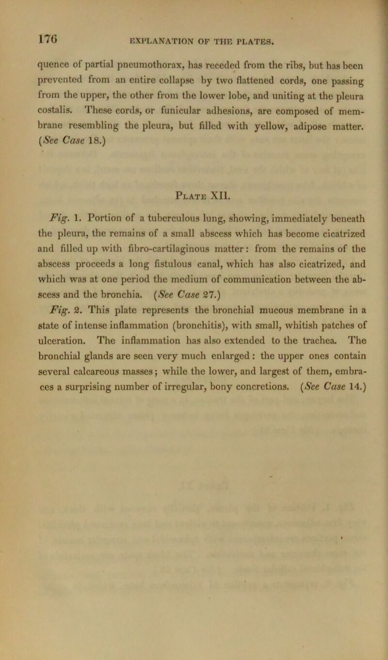 quence of partial pneumothorax, has receded from the ribs, but has been prevented from an entire collapse by two flattened cords, one passing from the upper, the other from the lower lobe, and uniting at the pleura costalis. These cords, or funicular adhesions, are composed of mem- brane resembling the pleura, but filled with yellow, adipose matter. (*Slee Case 18.) Plate XII. Fig. 1. Portion of a tuberculous lung, showing, immediately beneath the pleura, the remains of a small abscess which has become cicatrized and filled up with fibro-cartilaginous matter: from the remains of the abscess proceeds a long fistulous canal, which has also cicatrized, and which was at one period the medium of communication between the ab- scess and the bronchia. {See Case 27.) Fig. 2. This plate represents the bronchial mucous membrane in a state of intense inflammation (bronchitis), with small, whitish patches of ulceration. The inflammation has also extended to the trachea. The bronchial glands are seen very much enlarged : the upper ones contain several calcareous masses; while the lower, and largest of them, embra- ces a surprising number of irregular, bony concretions. (See Case 14.)