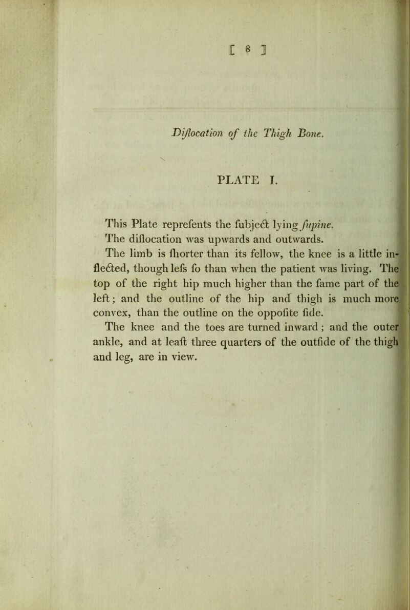 DiJIocation of the Thigh Bone. A PLATE T. This Plate reprefents the fubjeCt lying fupine. The diflocation was upwards and outwards. The limb is fhorter than its fellow, the knee is a little in- flected, though lefs fo than when the patient was living. The top of the right hip much higher than the fame part of the left; and the outline of the hip and thigh is much more convex, than the outline on the oppofite fide. The knee and the toes are turned inward; and the outer ankle, and at leaft three quarters of the outfide of the thigh and leg, are in view.