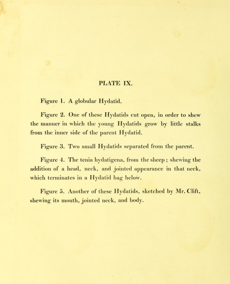 PLATE IX. Figure 1. A globular Hydatid. Figure 2. One of these Hydatids cut open, in order to shew the manner in which the young Hydatids grow hy little stalks from the inner side of the parent Hydatid. Figure 3. Two small Hydatids separated from the parent. Figure 4. The tenia hydatigena, from the sheep ; shewing the addition of a head, neck, and jointed appearance in that neck, which terminates in a Hydatid hag below. Figure 5. Another of these Hydatids, sketched by Mr. Clift, shewing its mouth, jointed neck, and body.