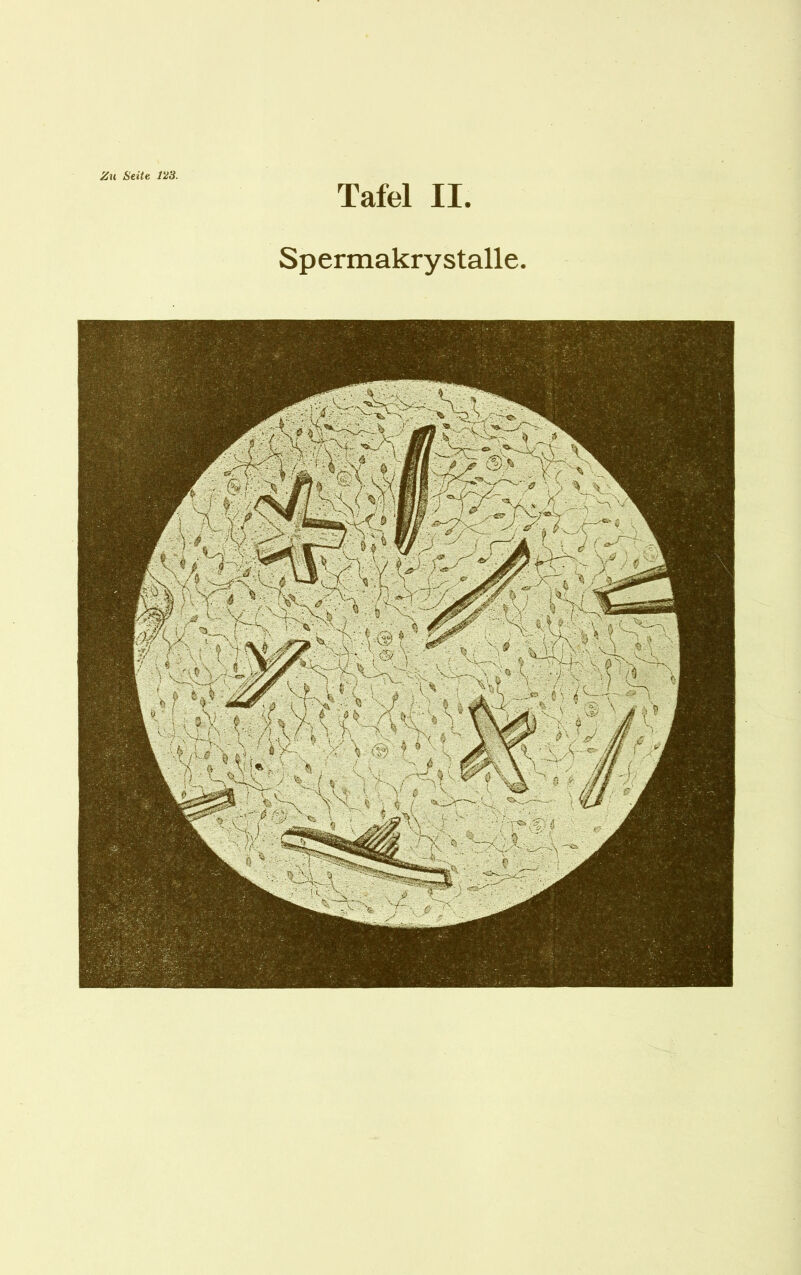 Zu Seite 1H3. Tafel II Spermakrystalle.