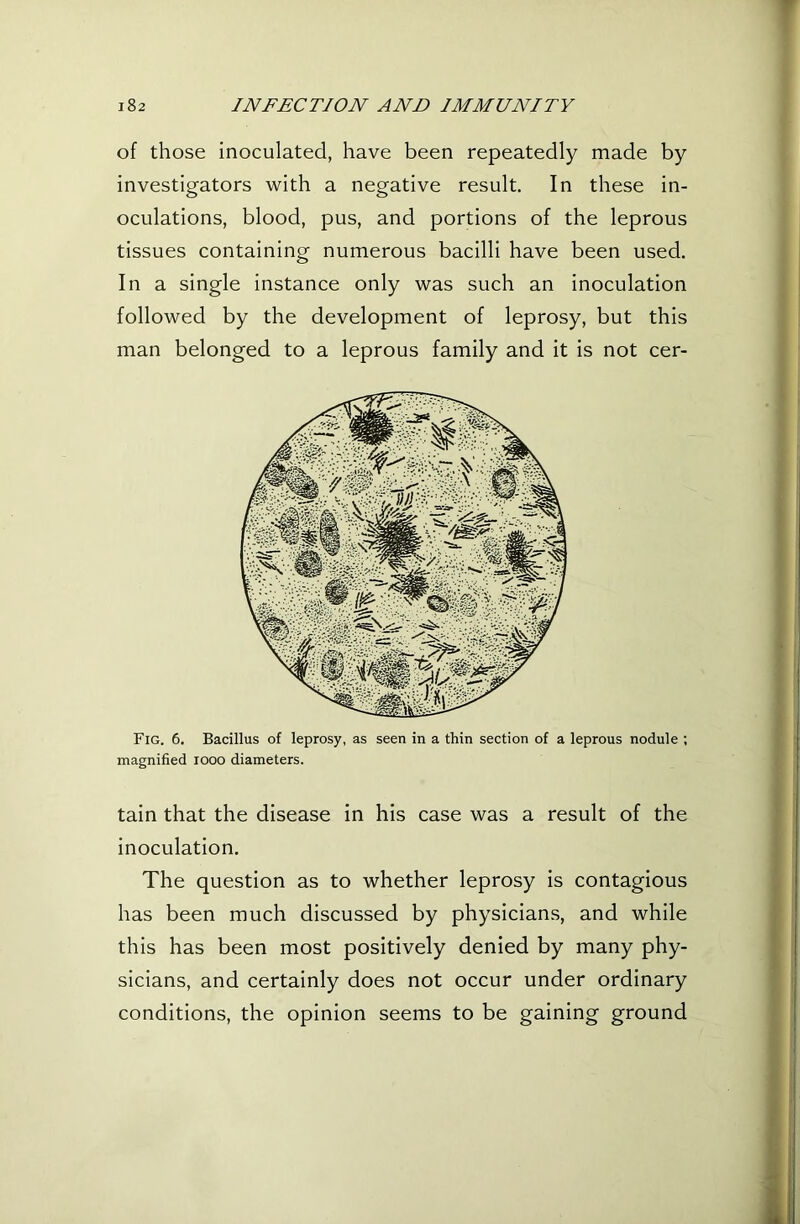 of those inoculated, have been repeatedly made by investigators with a negative result. In these in- oculations, blood, pus, and portions of the leprous tissues containing numerous bacilli have been used. In a single instance only was such an inoculation followed by the development of leprosy, but this man belonged to a leprous family and it is not cer- Fig. 6. Bacillus of leprosy, as seen in a thin section of a leprous nodule ; magnified looo diameters. tain that the disease in his case was a result of the inoculation. The question as to whether leprosy is contagious has been much discussed by physicians, and while this has been most positively denied by many phy- sicians, and certainly does not occur under ordinary conditions, the opinion seems to be gaining ground