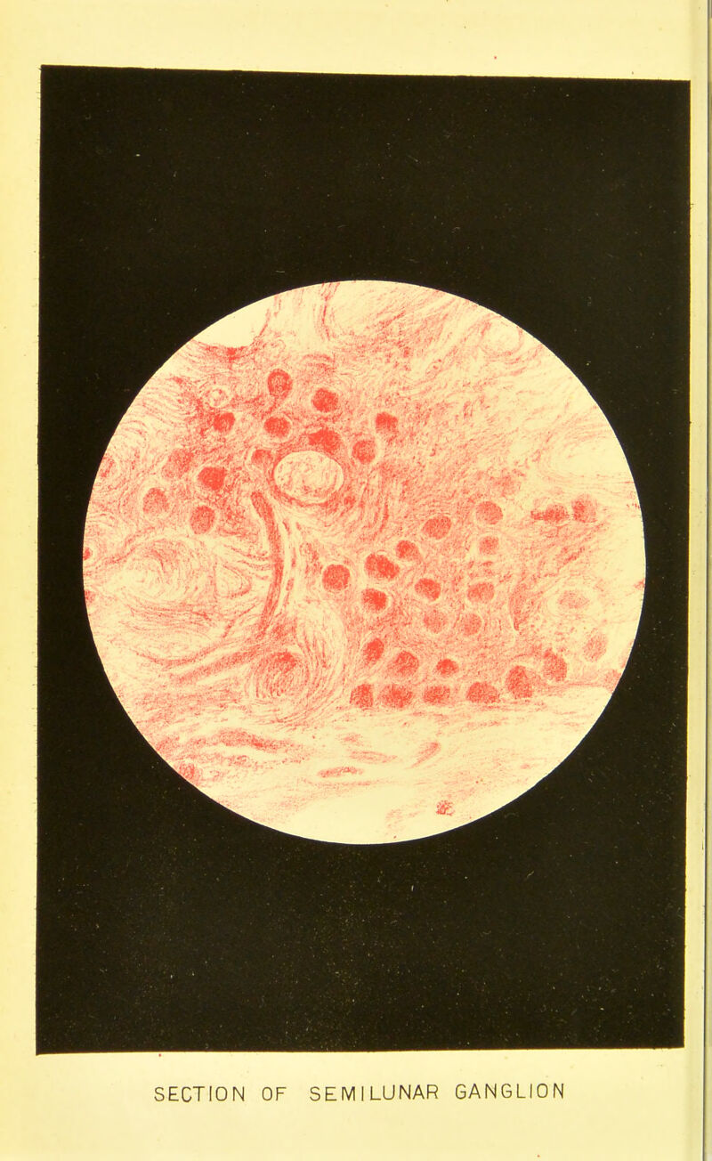 SECTION OF SEMILUNAR GANGLION