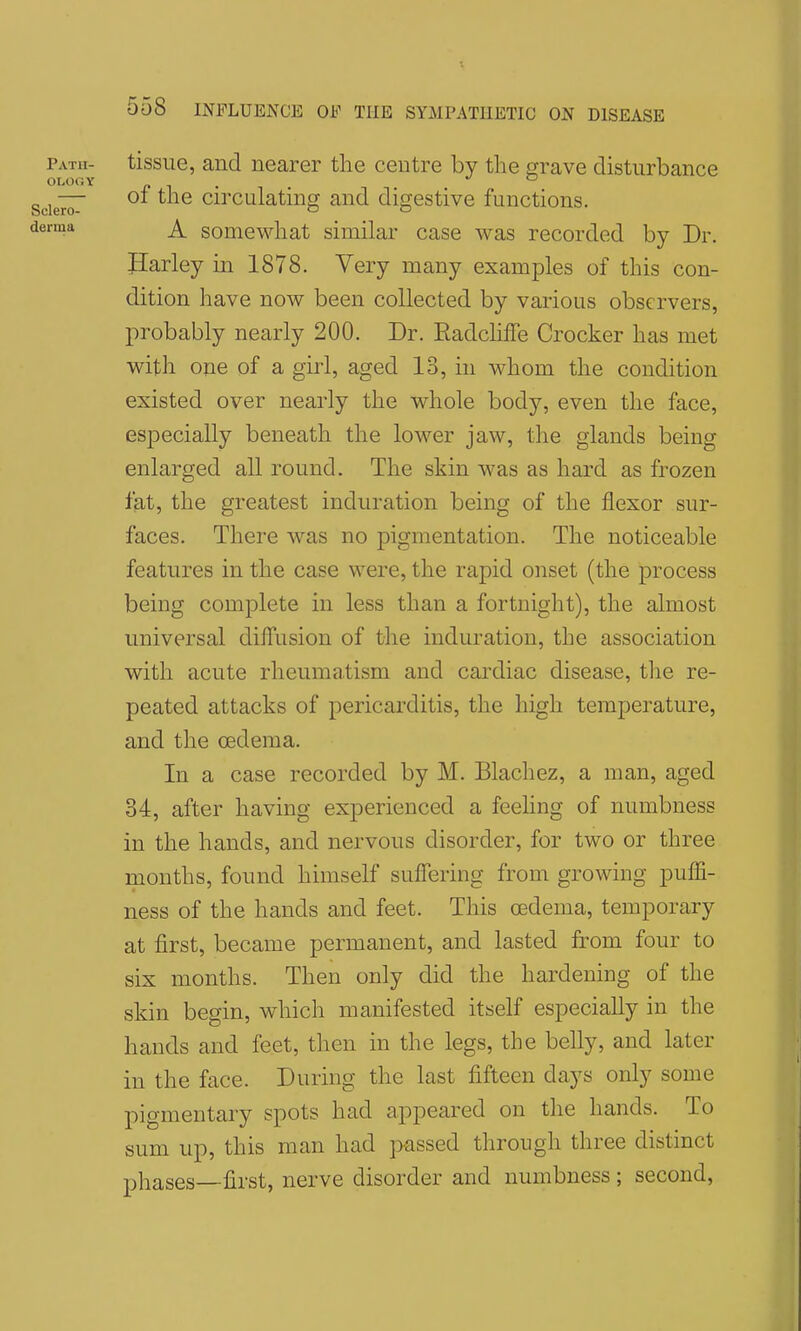 tissue, and nearer tlie centre by the grave disturbance of the circulating and digestive functions. A somewhat similar case was recorded by Dr. Harley in 1878. Very many examples of this con- dition have now been collected by various observers, probably nearly 200. Dr. Radcliffe Crocker has met with one of a girl, aged 13, in whom the condition existed over nearly the whole body, even the face, especially beneath the lower jaw, the glands being enlarged all round. The skin was as hard as frozen fat, the greatest induration being of the flexor sur- faces. There was no pigmentation. The noticeable features in the case were, the rapid onset (the process being complete in less than a fortnight), the almost universal diffusion of the induration, the association with acute rheumatism and cardiac disease, tlie re- peated attacks of pericarditis, the high temperature, and the oedema. In a case recorded by M. Blachez, a man, aged 34, after having experienced a feehng of numbness in the hands, and nervous disorder, for two or three months, found himself suflering from growing puffi- ness of the hands and feet. This oedema, temporary at first, became permanent, and lasted from four to six months. Then only did the hardening of the skin begin, which manifested itself especially in the hands and feet, then in the legs, the belly, and later in the face. During the last fifteen days only some pigmentary spots had appeared on the hands. To sum up, this man had passed through three distinct phases—first, nerve disorder and numbness ; second,
