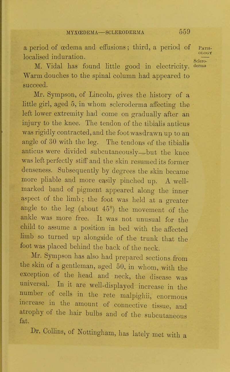 a period of oedema and effusions ; third, a period of Path- localised induration. ^ — Sclero- M. Vidal lias found little good in electricity, ^ermo Warm douches to the spinal column had appeared to succeed. Mr. Sympson, of Lincoln, gives the history of a httle girl, aged 5, in whom scleroderma affecting the left lower extremity had come on gradually after an injury to the knee. The tendon of the tibialis apticus was rigidly contracted, and the foot was (^raw^ up to an angle of 30 with the leg. The tendo^s qf the tibialis anticus were divided subcutaneously-^but the knee was left perfectly stiff and the skin resumed its former denseness. Subsequently by degrees the skin became more phable and more easily pinched up. A well- marked band of pigment appeared along the inner aspect of the hmb ; the foot was held at a greater angle to the leg (about 45°) the movement of the ankle was more free. It was not unusual for the child to assume a position in bed with the affected hmb so turned up alongside of the trunk that the foot was placed behind the back of the neck. Mr. Sympson has also had prepared sections from the skin of a gentleman, aged 50, in whom, with the exception of the head and neck, the disease was universal. In it are well-displayed increase in the number of cells in the rete malpighii, enormous increase in the amount of connective tissue, and atrophy of the hair bulbs and of the subcutaneous fat. Dr. Collins, of Nottingham, has lately met with a