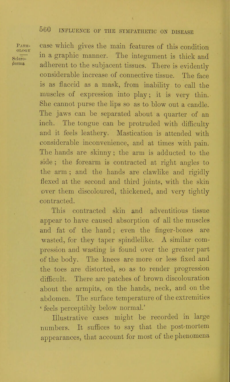 case which gives the main features of this condition in a graphic manner. The integument is thick and adherent to the subjacent tissues. There is evidently- considerable increase of connective tissue. The face is as flaccid as a mask, from inabihty to call the muscles of expressiop into play; it is very thin. She cannot purse the lips so as to blow out a candle. The jaws can be separated about a quarter of an inch. The tongue can be protruded with difficulty and it feels leathery. Mastication is attended with considerable inconvenience, and at times with pain. The hands are skinny ; the arm is adducted to the side ; the forearm is contracted at riglit angles to the arm ; and the hands are clawlike and rigidly flexed at the second and third joints, with the skin over them discoloured, thickened, and very tightly contracted. This contracted skin and adventitious tissue appear to have caused absorption of all the muscles and fat of the hand; even the finger-bones are wasted, for they taper spindlelike. A similar com- pression and wasting is found over the greater part of the body. The knees are more or less fixed and the toes are distorted, so as to render progression difficult. There are patches of brown discolouration about the armpits, on the hands, neck, and on the abdomen. The surface temperature of the extremities ' feels perceptibly below normal.' Illustrative cases might be recorded in large numbers. It suffices to say that the post-mortem appearances, that account for most of the phenomena