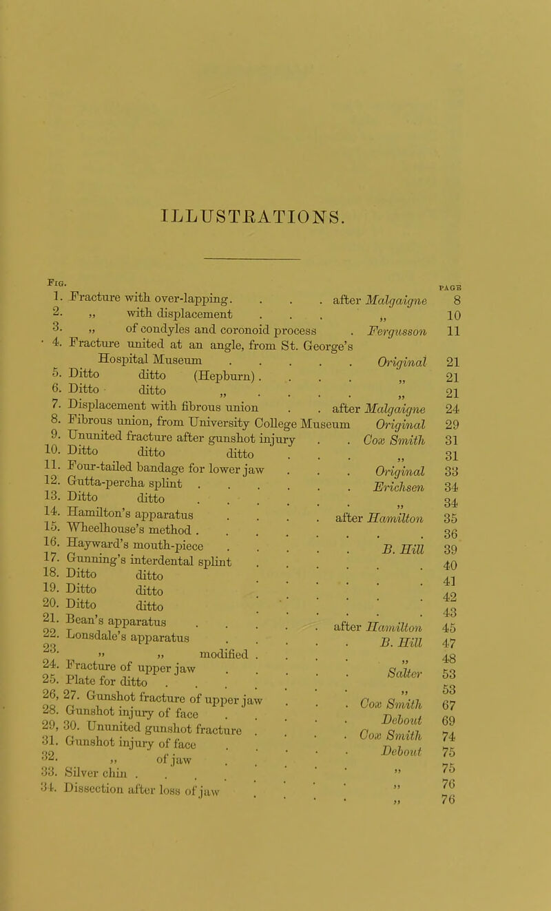 ILLUSTEATIONS. Fig 1. 2. 3. ■ 4. 5. 6. 7. 8. 9. 10. 11. 12. 13. 14. 15. 16. 17. 18. 19. 20. 21. 22. 23. 24. 25. 26, 28. 29, 31. 32. 33. 34. Fracture with, over-lapping. „ witli displacement „ of condyles and coronoid process Fracture united at an angle, from St. George's Hospital Museum Ditto ditto (Hepburn). Ditto ditto „ Displacement with fibrous imion Fibrous union, from University College Museum Ununited fracture after gunshot injury Ditto ditto ditto Four-tailed bandage for lower jaw Gutta-percha splint . Ditto ditto Hamilton's apparatus Wheelbouse's method . Hayward's mouth-jjiece Gunning's interdental splint Ditto ditto Ditto ditto Ditto ditto Bean's apparatus Lonsdale's apparatus  j> modified Fracture of upper jaw Plate for ditto .... 27. Gunshot fracture of upper jaw Gunshot injury of face 30. Ununited gunshot fracture Gimshot injuiy of face j> of jaw Silver chin ... Dissection alter loss of jaw after Malgaigne Fergusson Original jj >j after Malgaigne Original Cox Smith a Original Ericlism )j after Hamilton B. Hill after Hamilton B. Hill >> Salter >> . Gox Smith Dehout ■ Gox Smith Dehout PAGB 8 10 11 21 21 21 24 29 31 31 33 34 34 35 36 39 40 41 42 43 45 47 48 53 53 67 69 74 75 75 76 76