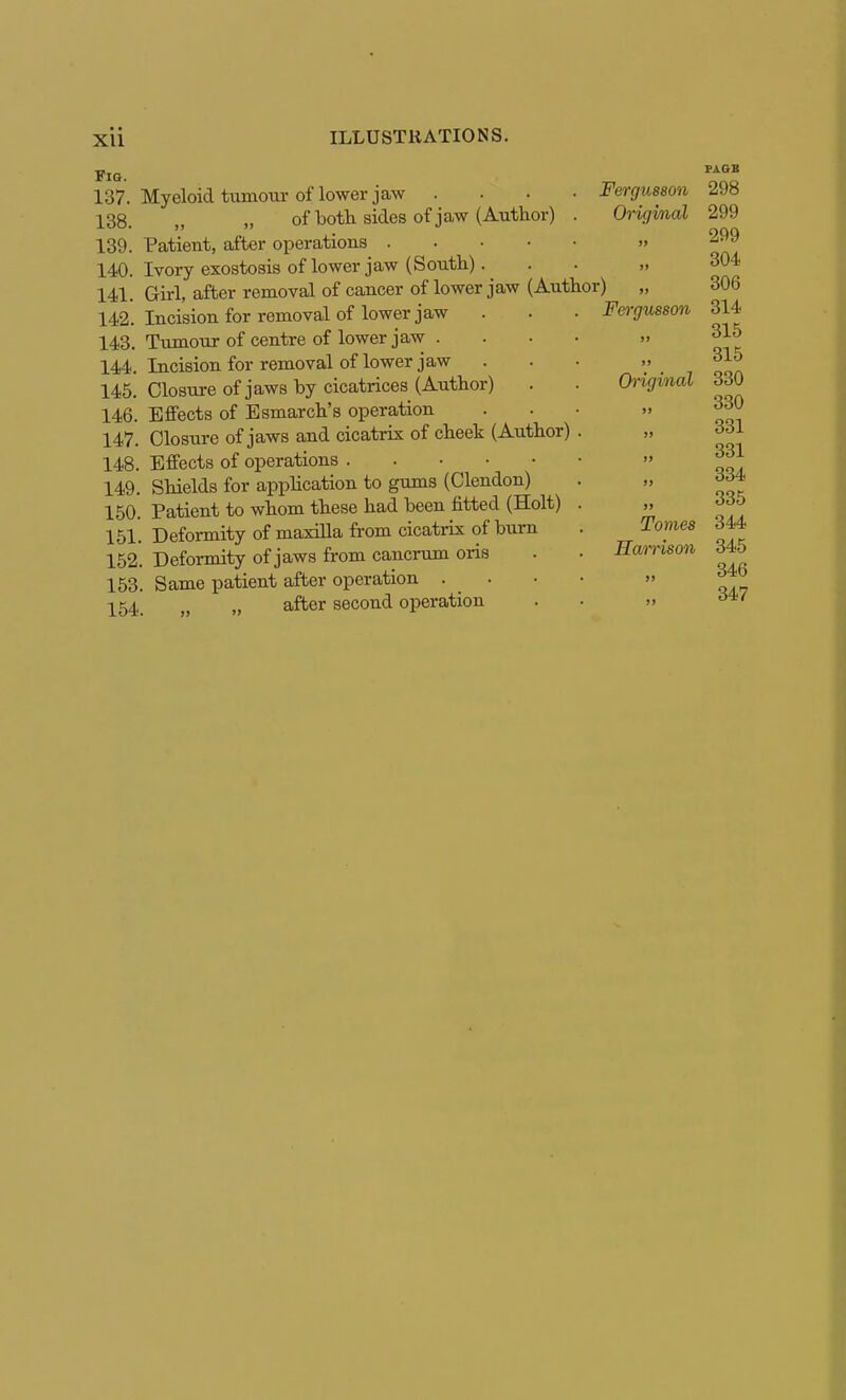 Xll Fig. 137. Myeloid tumour of lower jaw . . . • Fergusson 138. „ „ of both sides of jaw (Author) . Origmal 139. Patient, after operations » 140. Ivory exostosis of lower jaw (South). . • „ Girl, after removal of cancer of lower jaw (Author) 141. 142. 143. 144 Incision for removal of lower jaw Tumour of centre of lower jaw . Incision for removal of lower jaw 145. Closure of jaws by cicatrices (Author) 146. Effects of Esmarch's operation 147. Closure of jaws and cicatrix of cheek (Author) 148. Effects of operations 149. Shields for apphcation to gums (Olendon) 150. Patient to whom these had been fitted (Holt) 151. Deformity of maxilla from cicatrix of burn 152. Deformity of jaws from cancrum oris 153. Same patient after operation . . 154_ „ after second operation Fergusson Original Tomes Hamson Pi.GB 298 299 299 304 306 314 315 315 330 330 331 331 334 335 344 345 346 347