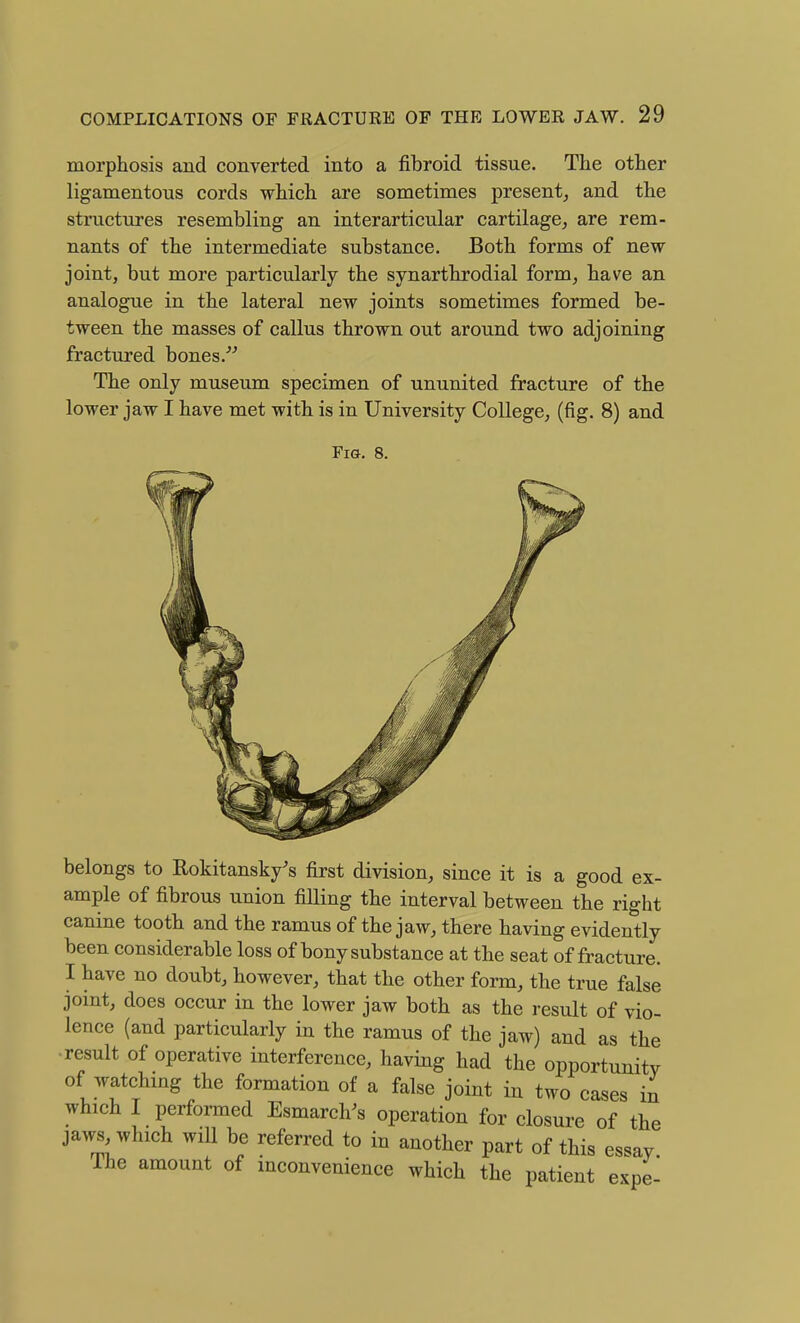 morphosis and converted into a fibroid tissue. The other ligamentous cords which are sometimes present^ and the structures resembling an interarticular cartilage^ are rem- nants of the intermediate substance. Both forms of new joint, but more particularly the synarthrodial form^ have an analogue in the lateral new joints sometimes formed be- tween the masses of callus thrown out around two adjoining fractured bones.^^ The only museum specimen of ununited fracture of the lower jaw I have met with is in University College, (fig. 8) and Fia. 8. belongs to Rokitansky's first division, since it is a good ex- ample of fibrous union filling the interval between the right canine tooth and the ramus of the jaw, there having evidently been considerable loss of bony substance at the seat of fracture. I have no doubt, however, that the other form, the true false joint, does occur in the lower jaw both as the result of vio- lence (and particularly in the ramus of the jaw) and as the result of operative interference, having had the opportunity of watchmg the formation of a false joint in two cases in which I performed Esmarch^s operation for closure of the jaws^which will be referred to in another part of this essay The amount of inconvenience which the patient expe-