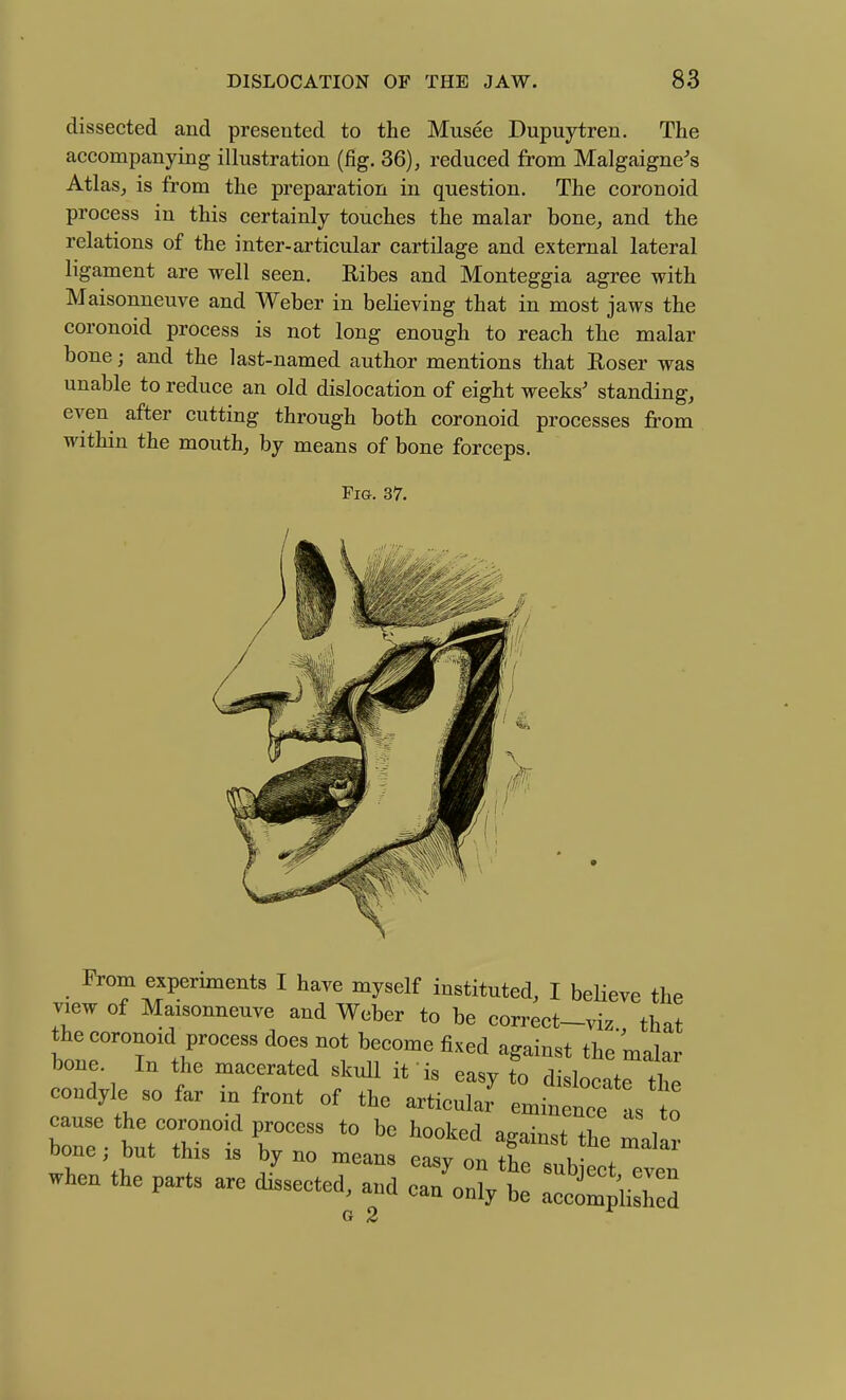 dissected and presented to the Musee Dupuytren. The accompanying illustration (fig. 36), reduced from Malgaigne's Atlas, is from the preparation in question. The coronoid process in this certainly touches the malar bone, and the relations of the inter-articular cartilage and external lateral ligament are well seen. Ribes and Monteggia agree with Maisonneuve and Weber in believing that in most jaws the coronoid process is not long enough to reach the malar bone; and the last-named author mentions that Eoser was unable to reduce an old dislocation of eight weeks' standing, even after cutting through both coronoid processes from within the mouth, by means of bone forceps. FiGr. 37. From experiments I have myself instituted, I beUeve the view of Maisonneuve and Weber to be connect-viz that bone. In the macerated skull it is easy to dislocate the condyle so far in front of the articular eminence as to when the parts are dissected, and .TJZX