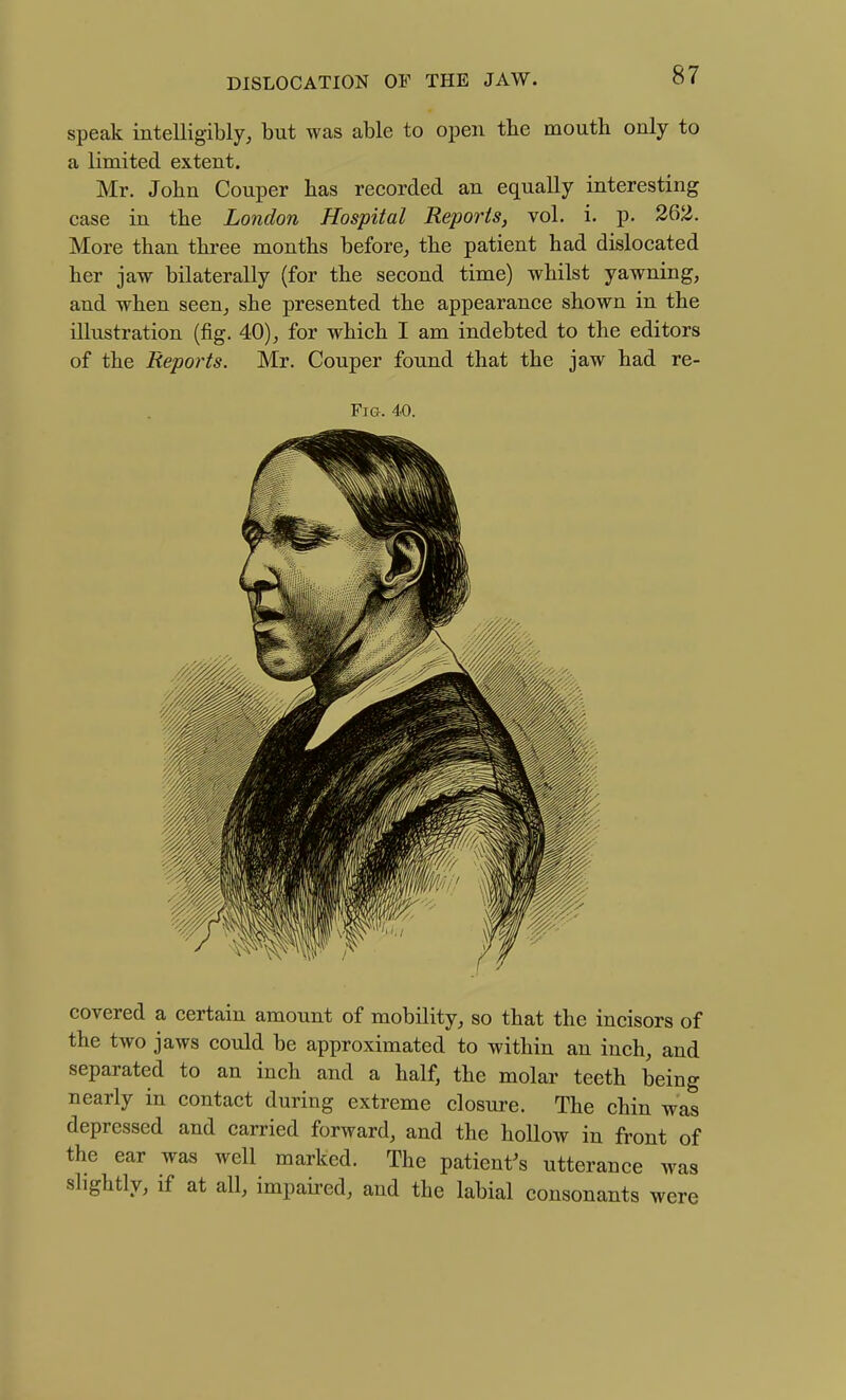 speak intelligibly; but was able to open the mouth only to a limited extent. Mr. John Couper has recorded an equally interesting case in the London Hospital Reports, vol. i. p. 262. More than three months before, the patient had dislocated her jaw bilaterally (for the second time) whilst yawning, and when seen, she presented the appearance shown in the illustration (fig. 40), for which I am indebted to the editors of the Reports. Mr. Couper found that the jaw had re- FiG. 4.0. covered a certain amount of mobility, so that the incisors of the two jaws could be approximated to within an inch, and separated to an inch and a half, the molar teeth being nearly in contact during extreme closure. The chin was depressed and carried forward, and the hollow in front of the ear was well marked. The patient^s utterance was slightly, if at all, impaired, and the labial consonants were