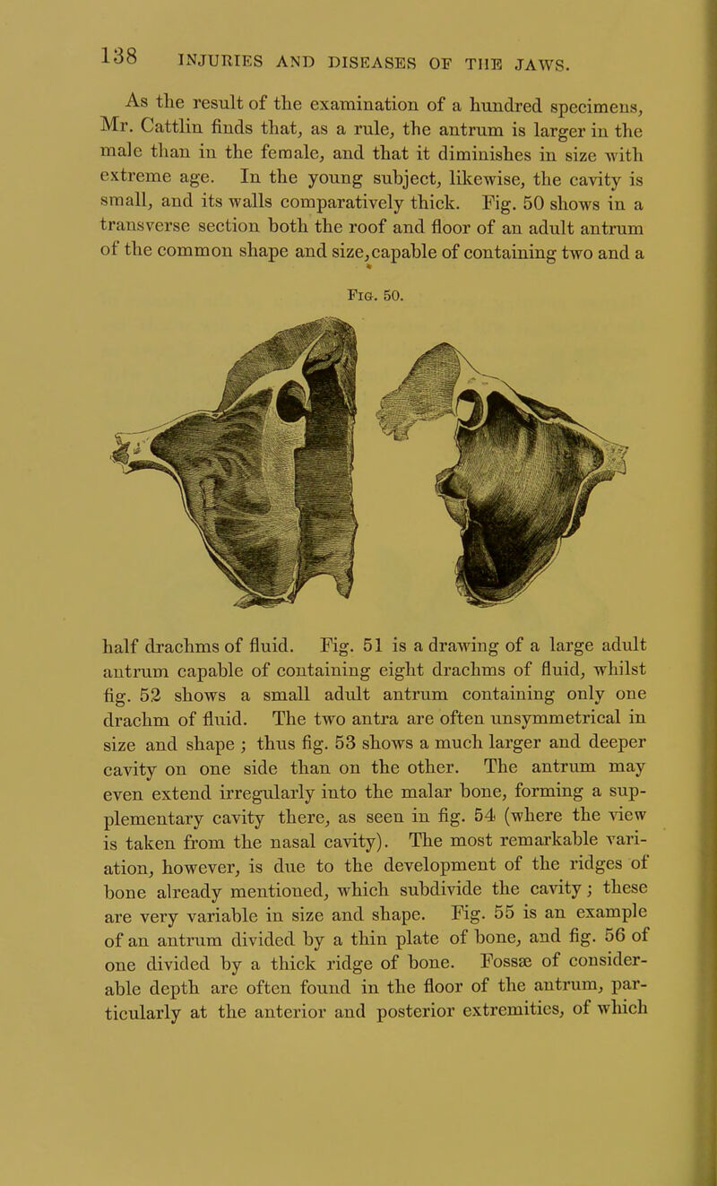 As the result of the examination of a hundred specimens, Mr. Cattlin finds that, as a rule, the antrum is larger in the male than in the female, and that it diminishes in size with extreme age. In the young subject, likewise, the cavity is small, and its walls comparatively thick. Fig. 50 shows in a transverse section both the roof and floor of an adult antrum of the common shape and size,capable of containing two and a Fia. 50. half drachms of fluid. Fig. 51 is a drawing of a large adult antrum capable of containing eight drachms of fluid, whilst fig. 52 shows a small adult antrum containing only one drachm of fluid. The two antra are often unsymmetrical in size and shape ; thus fig. 53 shows a much larger and deeper cavity on one side than on the other. The antrum may even extend irregularly into the malar bone, forming a sup- plementary cavity there, as seen in fig. 54 (where the view is taken from the nasal cavity). The most remarkable vari- ation, however, is due to the development of the ridges of bone already mentioned, which subdivide the cavity; these are very variable in size and shape. Fig. 55 is an example of an antrum divided by a thin plate of bone, and fig. 56 of one divided by a thick ridge of bone. Fossae of consider- able depth are often found in the floor of the antrum, par- ticularly at the anterior and posterior extremities, of which