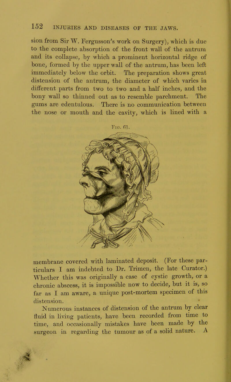 sion from Sir W. Fergusson's work on Surgery), which is due to the complete absorption of the front wall of the antrum and its collapse, by which a prominent horizontal ridge of bone, formed by the upper wall of the antrum, has been left immediately below the orbit. The preparation shows great distension of the antrum, the diameter of which varies in different parts from two to two and a half inches, and the bony wall so thinned out as to resemble parchment. The gums are edentulous. There is no communication between the nose or mouth and the cavity, which is lined with a membrane covered with laminated deposit. (For these par- ticulars I am indebted to Dr. Trimen, the late Curator.) Whether this was originally a case of cystic growth, or a chronic abscess, it is impossible now to decide, but it is, so far as I am aware, a unique post-mortem specimen of this distension. Numerous instances of distension of the antrum by clear fluid in living patients, have been recorded from time to time, and occasionally mistakes have been made by the surgeon in regarding the tumour as of a solid nature. A Fig. fil.