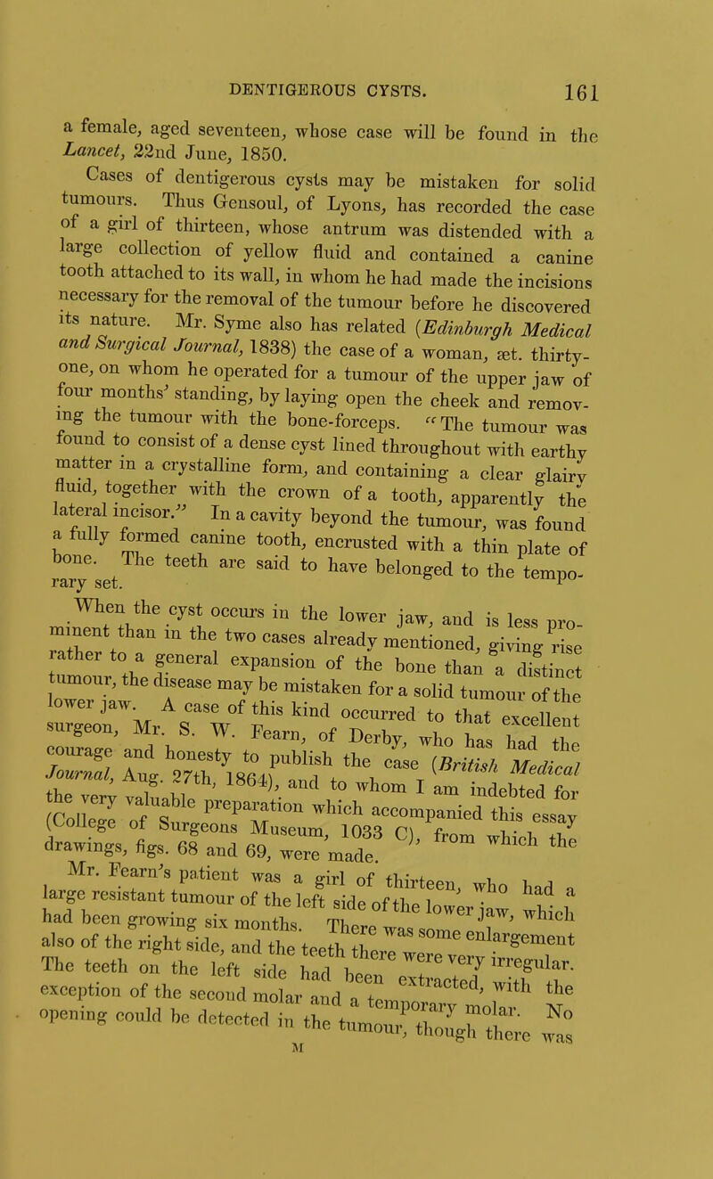 a female, aged seventeen, whose case will be found in the Lancet, 22nd June, 1850. Cases of dentigerous cysts may be mistaken for solid tumours. Thus Gensoul, of Lyons, has recorded the case of a girl of thirteen, whose antrum was distended with a large collection of yellow fluid and contained a canine tooth attached to its wall, in whom he had made the incisions necessaiy for the removal of the tumour before he discovered Its nature. Mr. Syme also has related {Edinburgh Medical and Surgical Journal, 1838) the case of a woman, ^et. thirty- one, on whom he operated for a tumour of the upper jaw of tour months^ standing, by laying open the cheek and remov- ing the tumour with the bone-forceps. -The tumour was found to consist of a dense cyst lined throughout with earthy matter m a crystalline form, and containing a clear glairv fluid, together with the crown of a tooth, apparently the lateral mcisor/^ In a cavity beyond the tumour, was found a fully formed camne tooth, encrusted with a thin plate of r^'set ''^ *° ^^^^ ^^^''^'^ *° the tempo- mment than ,n the two cases already mentioned, giving rise rather to a general expansion of the bone thail cuft n umour, the disease may be mistaken for a solid tumour of the suigeon, Mr. S. W. Fearn, of Derby, who has had th^ 3 w'Tth'^isB^rf (~ ^'^^ journal, Aug. 27th, 1864), and to whom I am indebted for CdWe f f' ^^^^^ accompaniedlht esst (College of Surgeons Museum, 1033 C) from ^hl^ drawings, figs. 68 and 69, were made Mr. Fearn^s patient was a girl of thirteen, who had . large resistant tumour of the left side of the lower Hw whtl had been growing six months. There was also of the right side and the tJT^ enlargement The teeth on t\.e lit ,-^^ exception of the second mo ar and a extracted, with the opening could be ^^^^^^