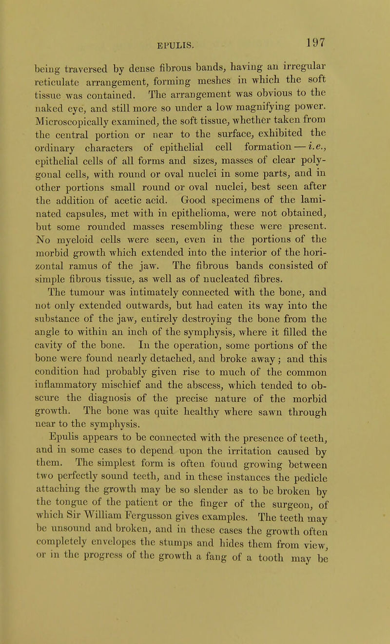 being traversed by dense fibrous bands, having an irregular reticulate arrangement, forming meshes in which the soft tissue was contained. The arrangement was obvious to the naked eye, and still more so under a low magnifying power. Microscopically examined, the soft tissue, Avhether taken from the central portion or near to the surface, exhibited the ordinary characters of epithelial cell formation — i.e., epithelial cells of all forms and sizes, masses of clear poly- gonal cells, with round or oval nuclei in some parts, and in other portions small round or oval nuclei, best seen after the addition of acetic acid. Good specimens of the lami- nated capsules, met with in epithelioma, were not obtained, but some rounded masses resembling these were present. No myeloid cells were seen, even in the portions of the morbid growth which extended into the interior of the hori- zontal ramus of the jaw. The fibrous bands consisted of simple fibrous tissue, as well as of nucleated fibres. The tumour was intimately connected with the bone, and not only extended outwards, but had eaten its way into the substance of the jaw, entirely destroying the bone from the angle to within an inch of the symphysis, where it filled the cavity of the bone. In the operation, some portions of the bone were found nearly detached, and broke away; and this condition had probably given rise to much of the common inflammatory mischief and the abscess, which tended to ob- scure the diagnosis of the precise nature of the morbid growth. The bone was quite healthy where sawn through near to the symphysis. Epulis appears to be connected with the presence of teeth, and in some cases to depend upon the irritation caused by them. The simplest form is often found growing between two perfectly sound teeth, and in these instances the pedicle attaching the growth may be so slender as to be broken by the tongue of the patient or the finger of the surgeon, of which Sir William Fergusson gives examples. The teeth may be unsound and broken, and in these cases the growth often completely envelopes the stumps and hides them from view, or in the progress of the growth a fang of a tooth may be