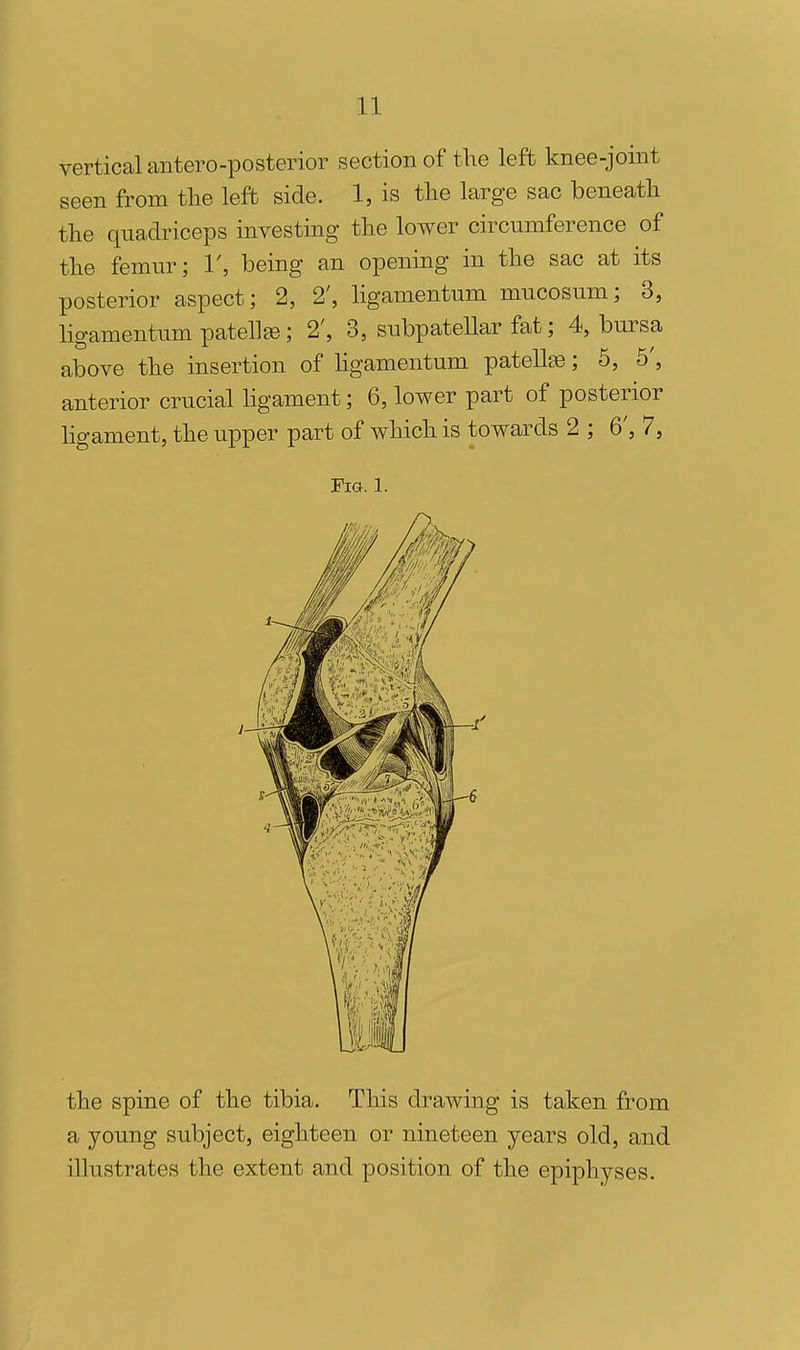 vertical antero-posterior section of the left knee-joint seen from tlie left side. 1, is the large sac beneath the quadriceps investing the lower circumference of the femur; 1', being an opening in the sac at its posterior aspect; 2, 2', ligamentum mucosum; 3, ligamentum patella; 2', 3, subpateUar fat; 4, bursa above the insertion of hgamentum patella; 6, 5', anterior crucial hgament; 6, lower part of posterior ligament, the upper part of which is towards 2 ; 6', 7, Fia. 1. the spine of the tibia. This drawing is taken from a young subject, eighteen or nineteen years old, and illustrates the extent and position of the epiphyses.