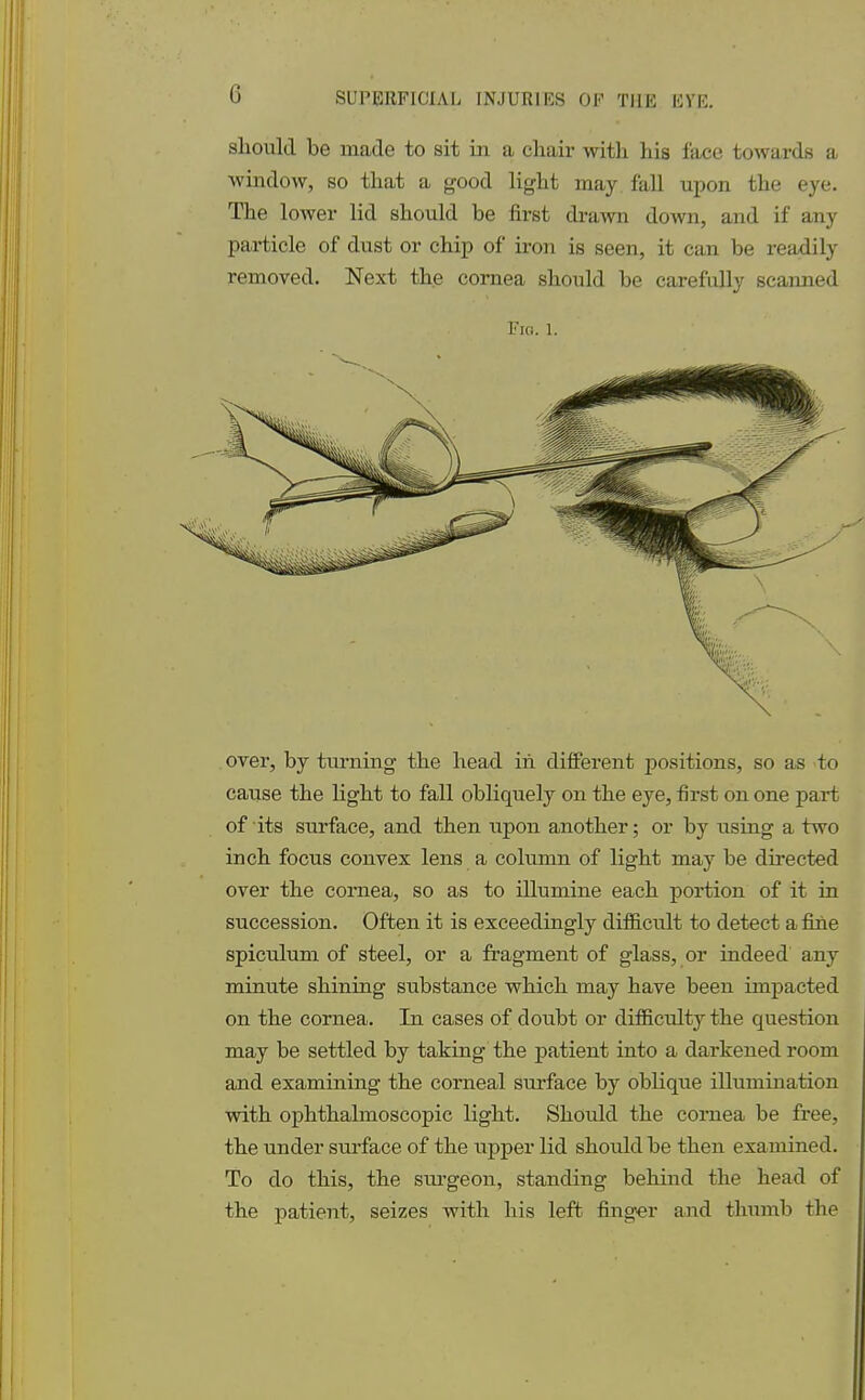 should be made to sit in a chair with his face towards a window, so that a good light may fall upon the eye. The loAver lid should be first drawn down, and if any particle of dust or chip of iron is seen, it can be readily removed. Next the cornea should be carefully scanned I'm;. 1. over, by turning the head in different positions, so as to cause the light to fall obliquely on the eye, first on one part of its surface, and then upon another; or by using a two inch focus convex lens a column of light may be directed over the cornea, so as to illumine each portion of it in succession. Often it is exceedingly difficidt to detect a fine spiculum of steel, or a fragment of glass, or indeed any minute shining substance which may have been impacted on the cornea. In cases of doubt or difficulty the question may be settled by taking the patient into a darkened room and examining the corneal surface by oblique illumination with ophthalmoscopic light. Should the cornea be free, the under surface of the upper lid should be then examined. To do this, the surgeon, standing behind the head of the patient, seizes with his left finger and thumb the