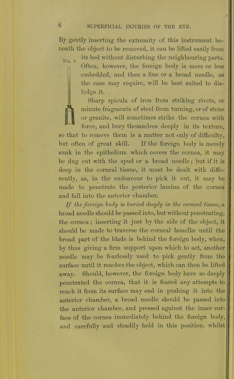 By gently inserting the extremity of this instrument be- neath the object to be removed, it can be lifted easily from its bed without disturbing the neighbouring parts. n Often, however, the foreign body is more or less embedded, and then a fine or a broad needle, as the case may require, will be best suited to dis- lodge it. Sharp spicula of iron from striking rivets, or rS* minute fragments of steel from turning, or of stone I; 1 or granite, will sometimes strike the cornea with force, and bury themselves deeply in its texture, so that to remove them is a matter not only of difficulty, but often of great skill. If the foreign body is merely sunk in the epithelium which covers the cornea, it may be dug out with the spud or a broad needle; but if it is deep in the corneal tissue, it must be dealt with diffe- rently, as, in the endeavour to pick it out, it may be made to penetrate the posterior lamina of the cornea and fall into the anterior chamber. If the foreign body is buried deeply in the corneal tissue, a broad needle should be passed into, but without penetrating, the cornea; inserting it just by the side of the object, it should be made to traverse the corneal lamellae until the broad part of the blade is behind the foreign body, when, by thus giving a firm support upon which to act, another needle may be fearlessly used to pick gently from the surface until it reaches the object, which can then be lifted away. Should, however, the foreign body have so deeply penetrated the cornea, that it is feared any attempts to reach it from its surface may end in pushing it into the anterior chamber, a broad needle should be passed into the anterior chamber, and pressed against the inner sur- face of the cornea immediately behind the foreign body, and carefully and steadily held in this position, whilst