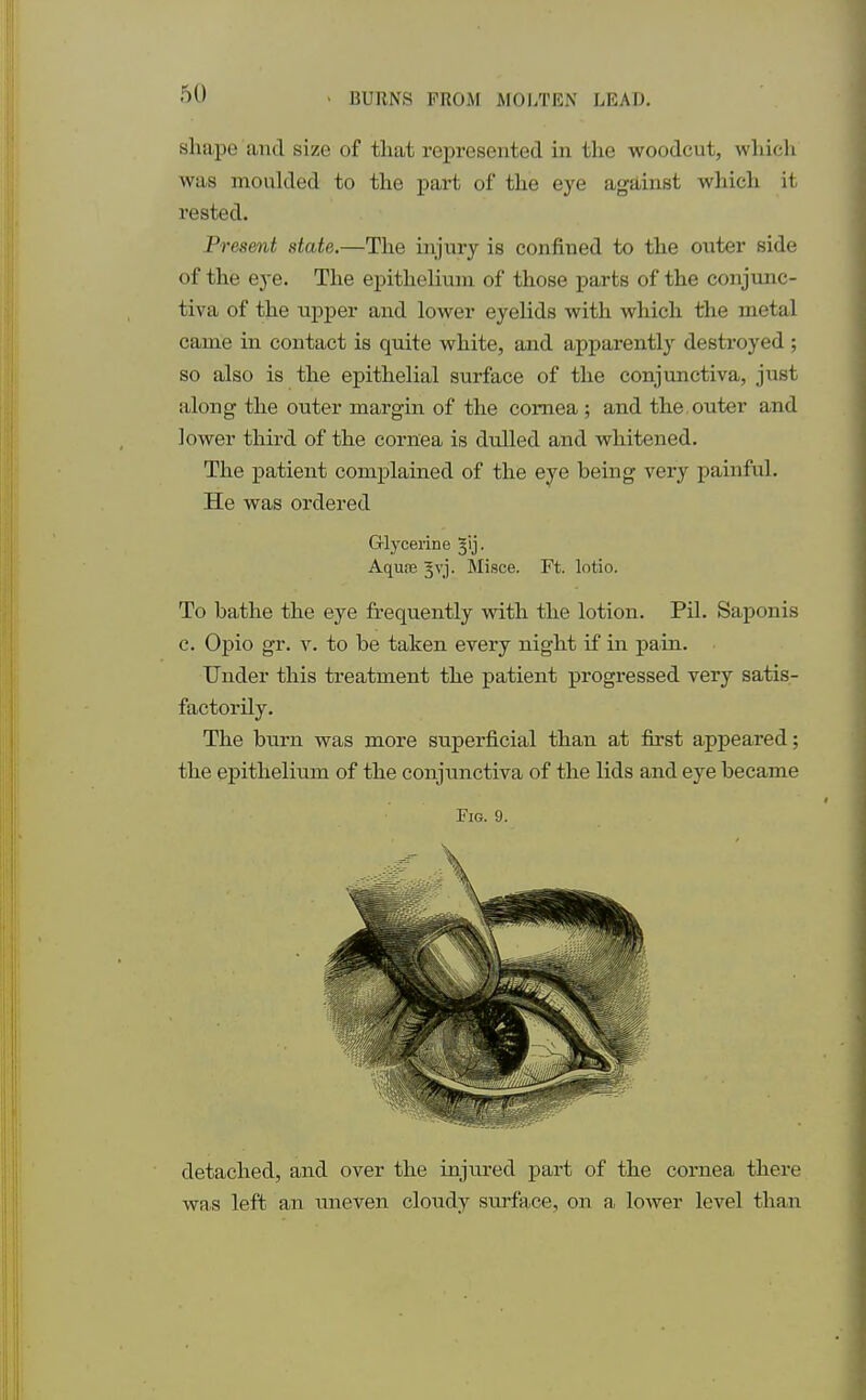 shape and size of that represented in the woodcut, wniel was moulded to the part of the eye against which it rested. Present state.—The injury is confined to the outer side of the eye. The epithelium of those parts of the conjunc- tiva of the upper and lower eyelids with which the metal came in contact is quite white, and apparently destroyed ; so also is the epithelial surface of the conjunctiva, just along the outer margin of the cornea ; and the.outer and lower third of the cornea is dulled and whitened. The patient complained of the eye being very painful. He was ordered Glycerine ^ij- Aqure ^vj. Misce. Ft. lotio. To bathe the eye frequently with the lotion. Pil. Saponis c. Opio gr. v. to be taken every night if in pain. Under this treatment the patient progressed very satis- factorily. The burn was more superficial than at first appeared; the epithelium of the conjunctiva of the lids and eye became Fig. 9. detached, and over the injured part of the cornea there was left an uneven cloudy surface, on a> lower level than