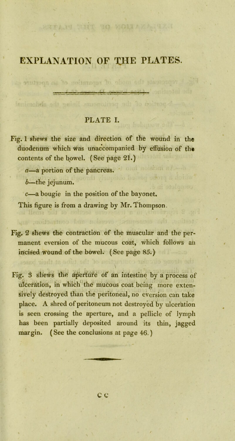 EXPLANATION OF THE PLATES. PLATE I. Fig. 1 shews the size and direction of the wound in the duodenum which was unaccompanied by effusion of the contents of the bowel. (See page 21.) a—a portion of the pancreas. b—the jejunum. c—a bougie in the position of the bayonet. This figure is from a drawing by Mr. Thompson. Fig. 2 shews the contraction of the muscular and the per- manent eversion of the mucous coat, which follows an incised wound of the bowel. (See page 85.) \ Fig. 3 shews the aperture of an intestine by a process of ulceration, in which the mucous coat being more exten- sively destroyed than the peritoneal, no eversion can take place. A shred of peritoneum not destroyed by ulceration is seen crossing the aperture, and a pellicle of lymph has been partially deposited around its thin, jagged margin. (See the conclusions at page 46.)