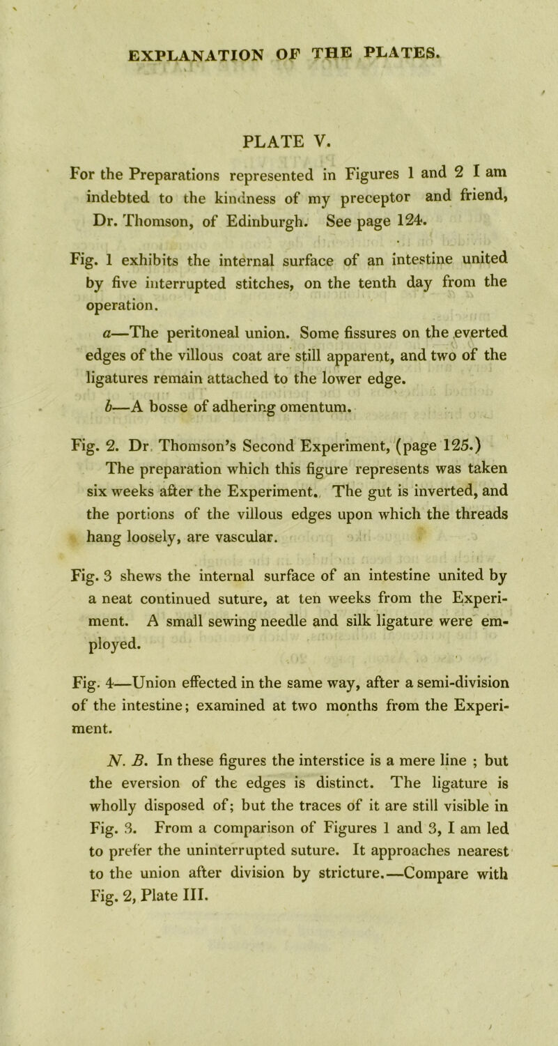 PLATE V. For the Preparations represented in Figures 1 and 2 I am indebted to the kindness of my preceptor and friend, Dr. Thomson, of Edinburgh. See page 124. Fig. 1 exhibits the internal surface of an intestine united by five interrupted stitches, on the tenth day from the operation. a—The peritoneal union. Some fissures on the everted edges of the villous coat are still apparent, and two of the ligatures remain attached to the lower edge. b—A bosse of adhering omentum. Fig. 2. Dr Thomson’s Second Experiment, (page 125.) The preparation which this figure represents was taken six weeks after the Experiment. The gut is inverted, and the portions of the villous edges upon which the threads hang loosely, are vascular. 1 ’ \ ’ i. Fig. 3 shews the internal surface of an intestine united by a neat continued suture, at ten weeks from the Experi- ment. A small sewing needle and silk ligature were em- ployed. Fig. 4—Union effected in the same way, after a semi-division of the intestine; examined at two months from the Experi- ment. N. B. In these figures the interstice is a mere line ; but the eversion of the edges is distinct. The ligature is wholly disposed of; but the traces of it are still visible in Fig. 3. From a comparison of Figures 1 and 3, I am led to prefer the uninterrupted suture. It approaches nearest to the union after division by stricture.—Compare with