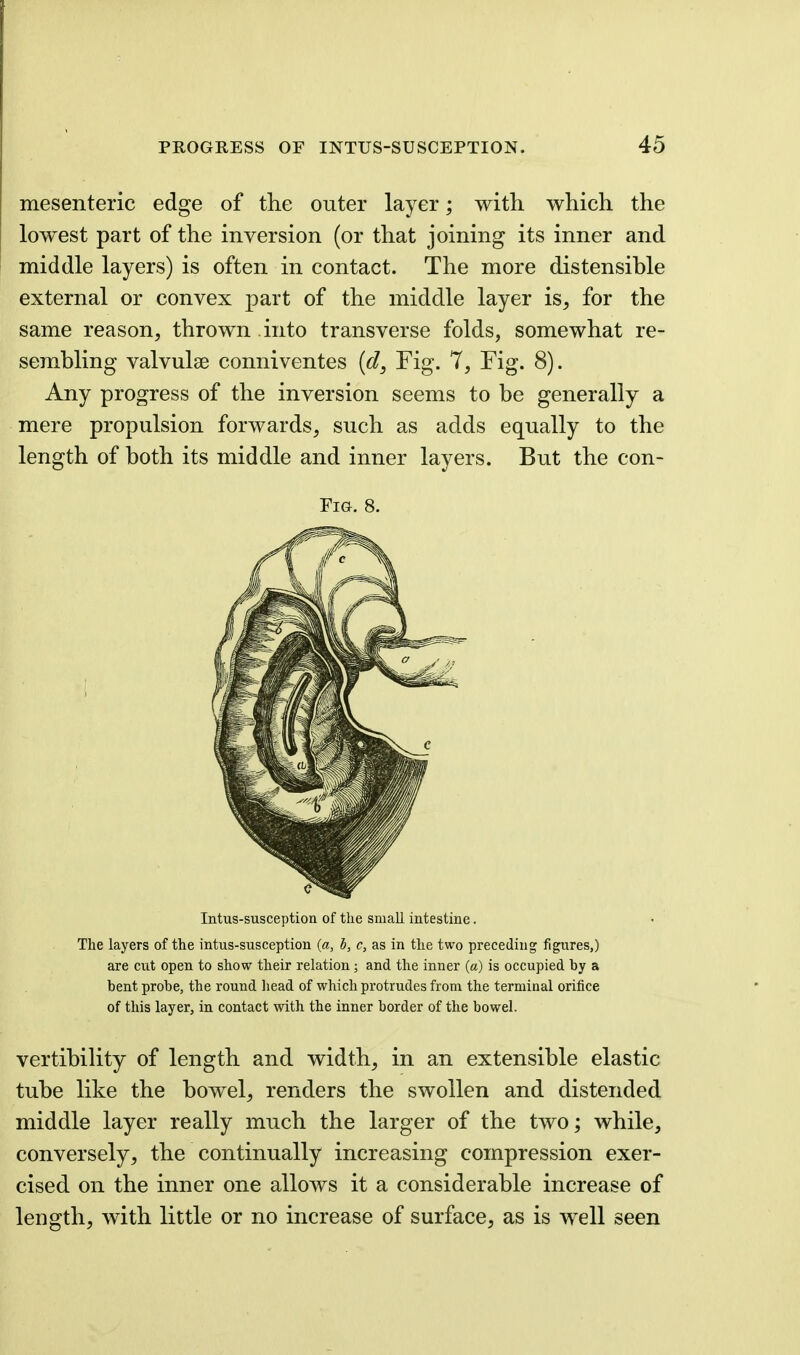 mesenteric edge of the outer layer; with which the lowest part of the inversion (or that joining its inner and middle layers) is often in contact. The more distensible external or convex part of the middle layer is^ for the same reason, thrown into transverse folds, somewhat re- sembling valvulse conniventes [d^ Fig. 7, Fig. 8). Any progress of the inversion seems to be generally a mere propulsion forwards, such as adds equally to the length of both its middle and inner layers. But the con- FiG-. 8. Intus-susception of the small intestine. The layers of the intus-susception (a, h, c, as in the two preceding figures,) are cut open to show their relation; and the inner («) is occupied by a bent probe, the round liead of which protrudes from the terminal orifice of this layer, in contact with the inner border of the bowel. vertibility of length and width, in an extensible elastic tube like the bowel, renders the swollen and distended middle layer really much the larger of the two; while, conversely, the continually increasing compression exer- cised on the inner one allows it a considerable increase of length, with little or no increase of surface, as is well seen