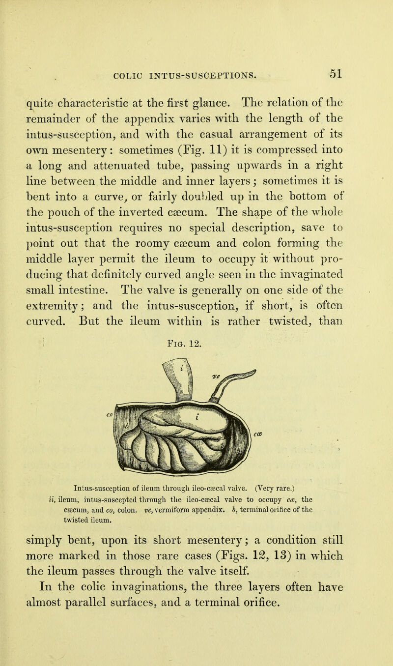 quite characteristic at the first glance. The relation of the remainder of the appendix varies with the length of the intus-susception, and with the casual arrangement of its own mesentery: sometimes (Fig. 11) it is compressed into a long and attenuated tube, passing upwards in a right line between the middle and inner layers ; sometimes it is bent into a curve^ or fairly doubled up in the bottom of the pouch of the inverted caecum. The shape of the whole intus-susception requires no special description, save to point out that the roomy csecum and colon forming the middle layer permit the ileum to occupy it without pro- ducing that definitely curved angle seen in the invaginated small intestine. The valve is generally on one side of the extremity; and the intus-susception, if short, is often curved. But the ileum within is rather twisted, than Fia. 12. Intus-susception of ileum tlirougli ileo-ctecal valve. (Very rare.) ii, ileum, intus-suscepted through the ileo-csecal valve to occupy cce, the csecum, and co, colon, ve, vermiform appendix, b, terminal orifice of the twisted ileum. simply bent, upon its short mesentery; a condition still more marked in those rare cases (Figs. 12, IS) in which the ileum passes through the valve itself. In the colic invaginations, the three layers often have almost parallel surfaces, and a terminal orifice.