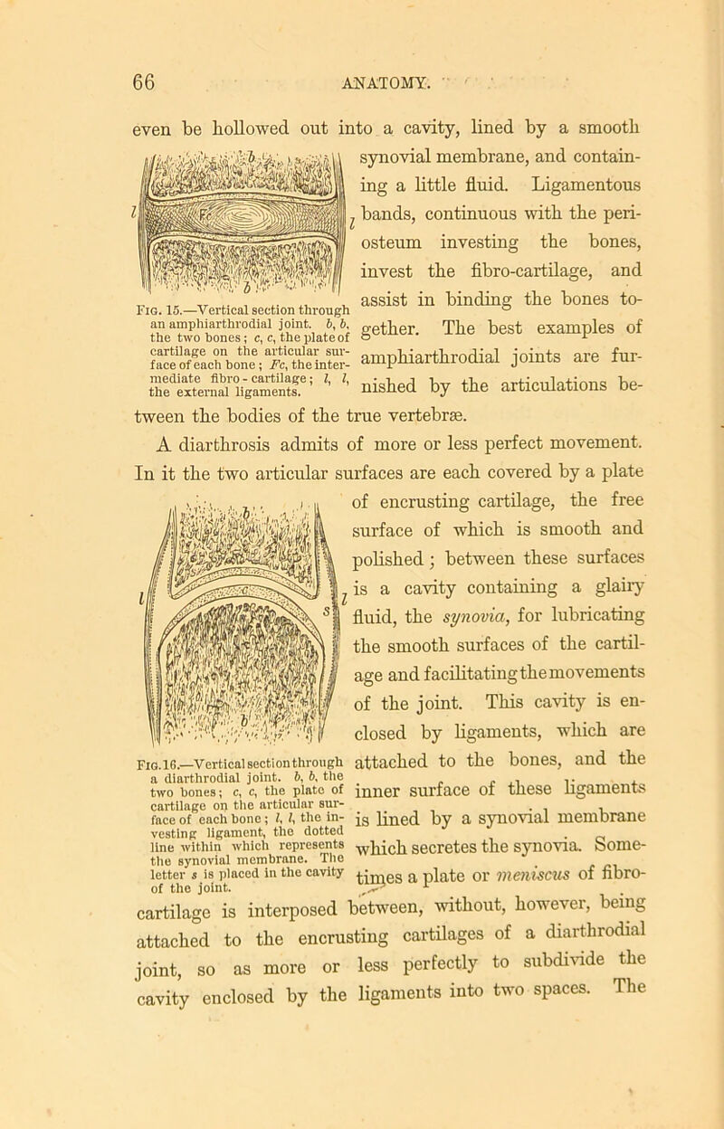 even be hollowed out into a cavity, lined by a smooth synovial membrane, and contain- ing a little fluid. Ligamentous bands, continuous with the peri- osteum investing the bones, invest the fibro-cartilage, and assist in binding the bones to- the two bones; c, e, theplateof S8tber- TI>° best samples of ZS^&iSSaZ amphiarthrodial joints are fur- gfSSJSVSS' 4 '■ aisled by tie articulations bo- tween the bodies of the true vertebrae. Fig. 15.—Vertical section through an amphiarthrodial joint. 6, 6, cither A diarthrosis admits of more or less perfect movement. In it the two articular surfaces are each covered by a plate of encrusting cartilage, the free surface of which is smooth and polished ; between these surfaces is a cavity containing a glairy fluid, the synovia, for lubricating the smooth surfaces of the cartil- age and facilitating the movements of the joint. This cavity is en- closed by ligaments, which are Fig. 16.—verticai secti on through attached to the bones, and the a diarthrodial joint. 6, b, the , . ,. , two bones; c, c, the plate of inner surface of tnese ligaments cartilage on the articular sur- . face of each bone; i, i, the in- jg iined by a synovial membrane vesting ligament, the dotted . line within which represents secretes the synovia. oome- the synovial membrane. The _ letter s is placed in the cavity ^in-,es a plate 01' VieilisCUS of fibrO- of the joint. r cartilage is interposed between, without, however, being attached to the encrusting cartilages of a diarthrodial joint, so as more or less perfectly to subdivide the cavity enclosed by the ligaments into two spaces. The