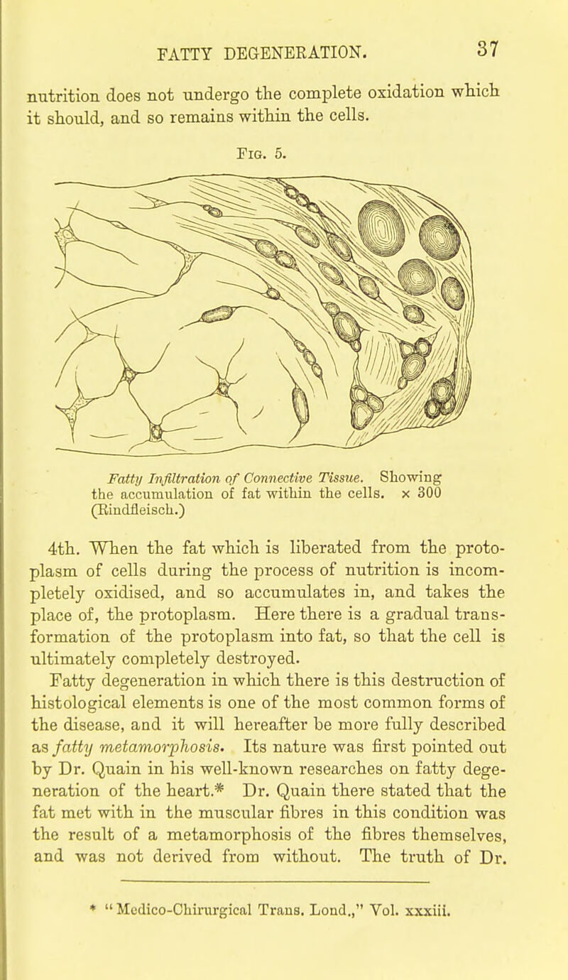 nutrition does not undergo the complete oxidation which it should, and so remains within the cells. Fig. 5. Fatty Infiltration of Connective Tissue. Showing the accumulation of fat within the cells, x 300 (Eindfleisch.) 4th. When the fat which is liberated from the proto- plasm of cells during the process of nutrition is incom- pletely oxidised, and so accumulates in, and takes the place of, the protoplasm. Here there is a gradual trans- formation of the protoplasm into fat, so that the cell is ultimately completely destroyed. Fatty degeneration in which there is this destruction of histological elements is one of the most common forms of the disease, and it will hereafter be more fully described as fatty metamorphosis. Its nature was first pointed out by Dr. Quain in his well-known researches on fatty dege- neration of the heart.* Dr. Quain there stated that the fat met with in the muscular fibres in this condition was the result of a metamorphosis of the fibres themselves, and was not derived from without. The truth of Dr. ♦  Medico-Chinirgical Trans, Lend., Vol. xxxiii.