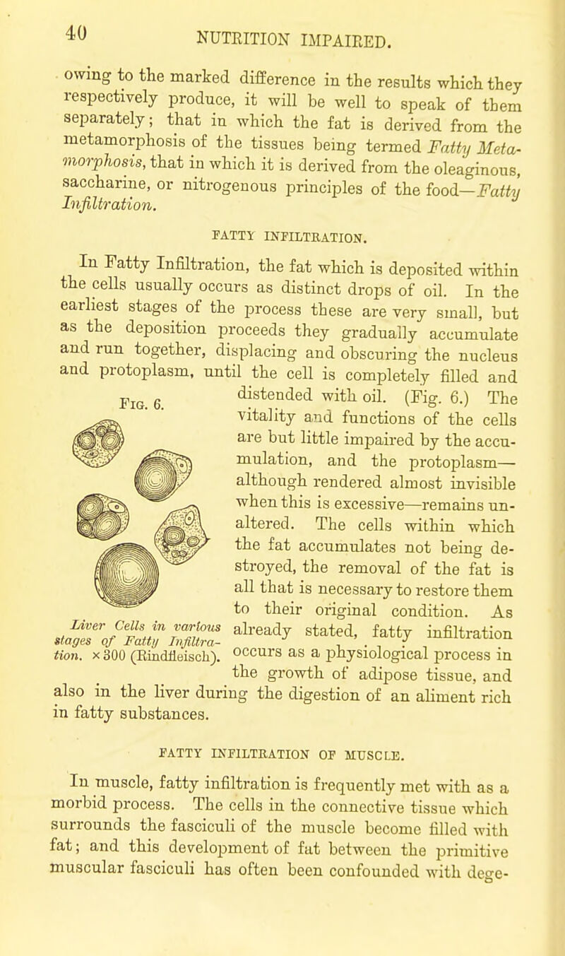 owing to the marked difference in the results which they respectively produce, it will be well to speak of them separately; that in which the fat is derived from the metamorphosis of the tissues being termed Fatty Meta- morphosis, that in which it is derived from the oleaginous, saccharine, or nitrogenous principles of the food.—Fatty Infiltration. ¥ATTY INFILTRATION. In Fatty Infiltration, the fat which is deposited within the cells usually occurs as distinct drops of oil. In the earliest stages of the process these are very small, but as the deposition proceeds they gradually accumulate and run together, displacing and obscuring the nucleus and protoplasm, until the cell is completely filled and distended with oil. (Pig. 6.) The vitality and functions of the cells are but little impaired by the accu- mulation, and the protoplasm— although rendered almost invisible when this is excessive—remains un- altered. The cells within which the fat accumulates not being de- stroyed, the removal of the fat is all that is necessary to restore them to their original condition. As already stated, fatty infiltration occurs as a physiological process in the growth of adipose tissue, and also in the liver during the digestion of an aliment rich in fatty substances. Liver Cells in various stages of Fatty Infiltra- tion. X 300 (Eindileisch). PATTY INFILTRATION OF MUSCLE. In muscle, fatty infiltration is frequently met with as a morbid process. The cells in the connective tissue which surrounds the fascicuH of the muscle become filled with fat; and this development of fat between the primitive muscular fasciculi has often been confounded with deo-e-