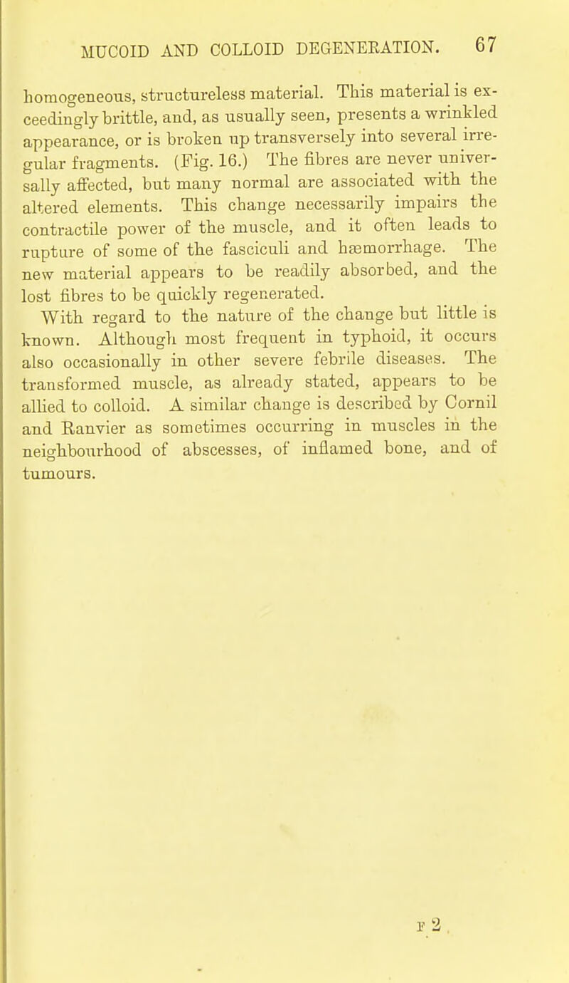 horaogeneoiis, structureless materiaL This material is ex- ceedingly brittle, and, as usually seen, presents a wrinkled appearance, or is broken up transversely into several irre- gular fragments. (Fig. 16.) The fibres are never univer- sally affected, but many normal are associated with the altered elements. This change necessarily impairs the contractile power of the muscle, and it often leads to rupture of some of the fasciculi and hgemorrhage. The new material appears to be readily absorbed, and the lost fibres to be quickly regenerated. With regard to the nature of the change but little is known. Although most frequent in typhoid, it occurs also occasionally in other severe febrile diseases. The transformed muscle, as already stated, appears to be aUied to colloid. A similar change is described by Cornil and Eanvier as sometimes occurring in muscles in the neighbourhood of abscesses, of inflamed bone, and of tumours.