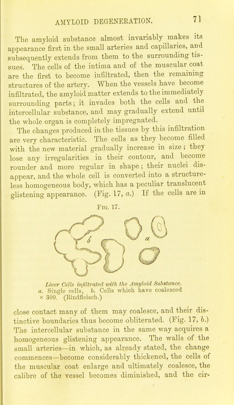 The amyloid substance almost invariably makes its appearance first in the small arteries and capillaries, and subsequently extends from them to the surrounding tis- sues. The cells of the intima and of the muscular coat are the first to become infiltrated, then the remaining structures of the artery. When the vessels have become infiltrated, the amyloid matter extends to the immediately surrounding parts; it invades both the cells and the intercellular substance, and may gradually extend until the whole organ is completely impregnated. The changes produced in the tissues by this infiltration are very characteristic. The cells as they become filled with the new material gradually increase in size ; they lose any irregularities in their contour, and become rounder and more regular in shape; their nuclei dis- appear, and the whole cell is converted into a structure- less homogeneous body, which has a peculiar translucent glistening appearance. (Fig. 17, a.) If the cells are in Fig. 17. Liver Cells infiltrated with the Amyloid Substance, a. Single cells, 6. Cells which have coalesced X 300. (Rindfleisch.) close contact many of them may coalesce, and their dis- tinctive boundaries thus become obliterated. (Fig. 17, h.) The intercellular substance in the same way acquires a homogeneous glistening appearance. The walls of the small arteries—in which, as already stated, the change commences—become considerably thickened, the cells of the muscular coat enlarge and ultimately coalesce, the calibre of the vessel becomes diminished, and the cir-