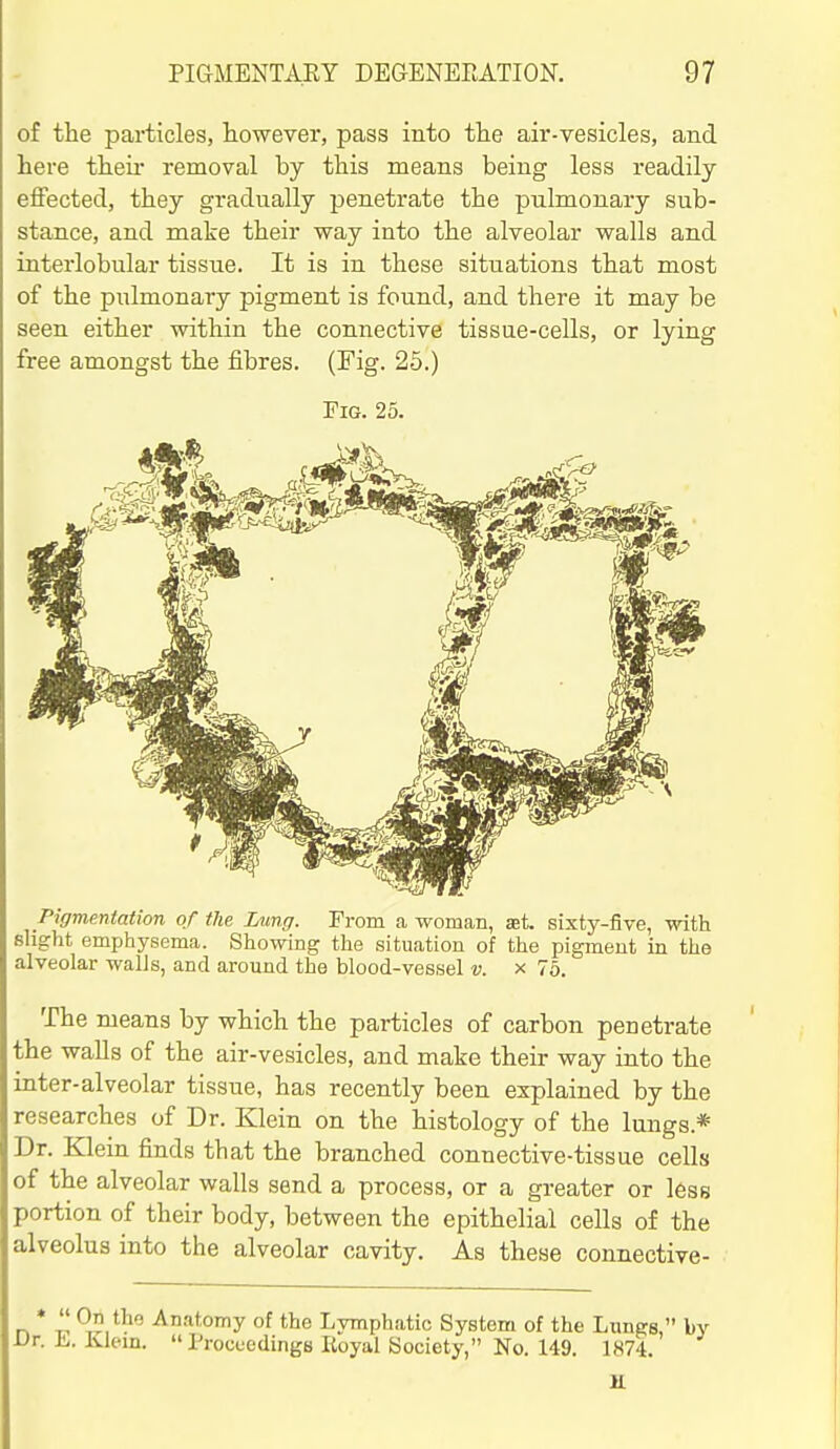 of the particles, however, pass into the air-vesicles, and here theii- removal by this means being less readily effected, they gradually penetrate the pulmonary sub- stance, and make their way into the alveolar walls and interlobular tissue. It is in these situations that most of the pulmonary pigment is found, and there it may be seen either within the connective tissue-cells, or lying free amongst the fibres. (Fig. 25.) Fig. 25. Pigmentation of the Lung. From a woman, set. sixty-five, with slight emphysema. Showing the situation of the pigment in the alveolar walls, and around the blood-vessel v. x 76. The means by which the particles of carbon penetrate the walls of the air-vesicles, and make their way into the inter-alveolar tissue, has recently been explained by the researches of Dr. Klein on the histology of the lungs.* Dr. Klein finds that the branched connective-tissue cells of the alveolar walls send a process, or a greater or less portion of their body, between the epithelial cells of the alveolus into the alveolar cavity. As these connective-  On the Dr. E ; On the Anatomy of the Lymphatic System of the Lunge, by i. Klein. ProceedingB Royal Society, No. 149. 1874. 11