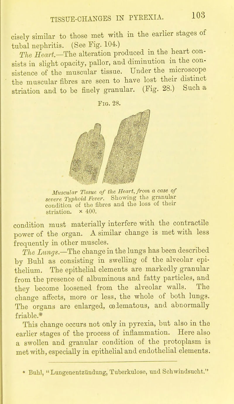 TISSUE-CHANGES IN PYREXIA. cisely similar to those met with in the earlier stages of tubal nephritis. (See Fig. 104.) The Heart—The alteration produced in the heart con- sists in slight opacity, paUor, and diminution in the con- sistence of the musciilar tissue. Under the microscope the muscular fibres are seen to have lost their distmct striation and to be finely granular. (Fig. 28.) Such a Fig. 28. Muscular Tissue of the Heart, from a case of severe Typhoid Fever. Showing the granular condition of the fibres and the loss of their striation. x 400. condition must materially interfere with the contractile power of the organ. A similar change is met with less frequently in other muscles. The Lungs.—The change in the lungs has been described by Buhl as consisting in swelling of the alveolar epi- thelium. The epithelial elements are markedly granular from the presence of albuminous and fatty particles, and they become loosened from the alveolar walls. The change affects, more or less, the whole of both lungs. The organs are enlarged, oeiematous, and abnormally friable.* This change occurs not only in pyrexia, but also in the earlier stages of the process of inflammation. Here also a swollen and granular condition of the protoplasm is met with, especially in epithelial and endothelial elements. * Buhl,  Lungenentziindung, Tuberkulose, und Schwindsucht.