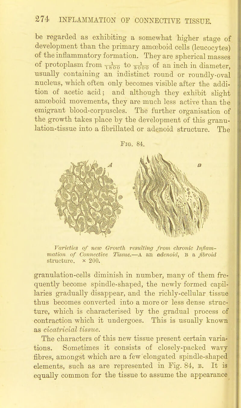 be regarded as exhibiting a somewhat higher stage of development than the primary amoeboid cells (leucocytes) of the inflammatory formation. They are spherical masses of protoplasm from -^^^ to of an inch in diameter, usnaUy containing an indistinct ronnd or roundly-oval nucleus, which often only becomes visible after the addi- tion of acetic acid; and although they exhibit slight amoeboid movements, they are much less active than tbe emigrant blood-corpuscles. The further organisation of the growth takes place by the development of this granu- lation-tissue into a fibrillated or adenoid structure. The Fig. 84. Varieties of new Growth resulting from chronic Inflam- mation of Connective Tissue.—A an adenoid, B a fibroid structure, x 200. granulation-cells diminish in number, many of them fre- quently become spindle-shaped, the newly formed capil- laries gradually disappear, and the richly-cellular tissue thus becomes converted into a more or less dense struc- ture, which is characterised by the gradual process of contraction which it undergoes. This is usually known as cicatricial tissue. The characters of this new tissue present certain varia- tions. Sometimes it consists of closely-packed wavy fibres, amongst which are a few elongated spindle-shaped elements, such as are represented in Fig. 84, b. It is equally common for the tissue to assume the appearance