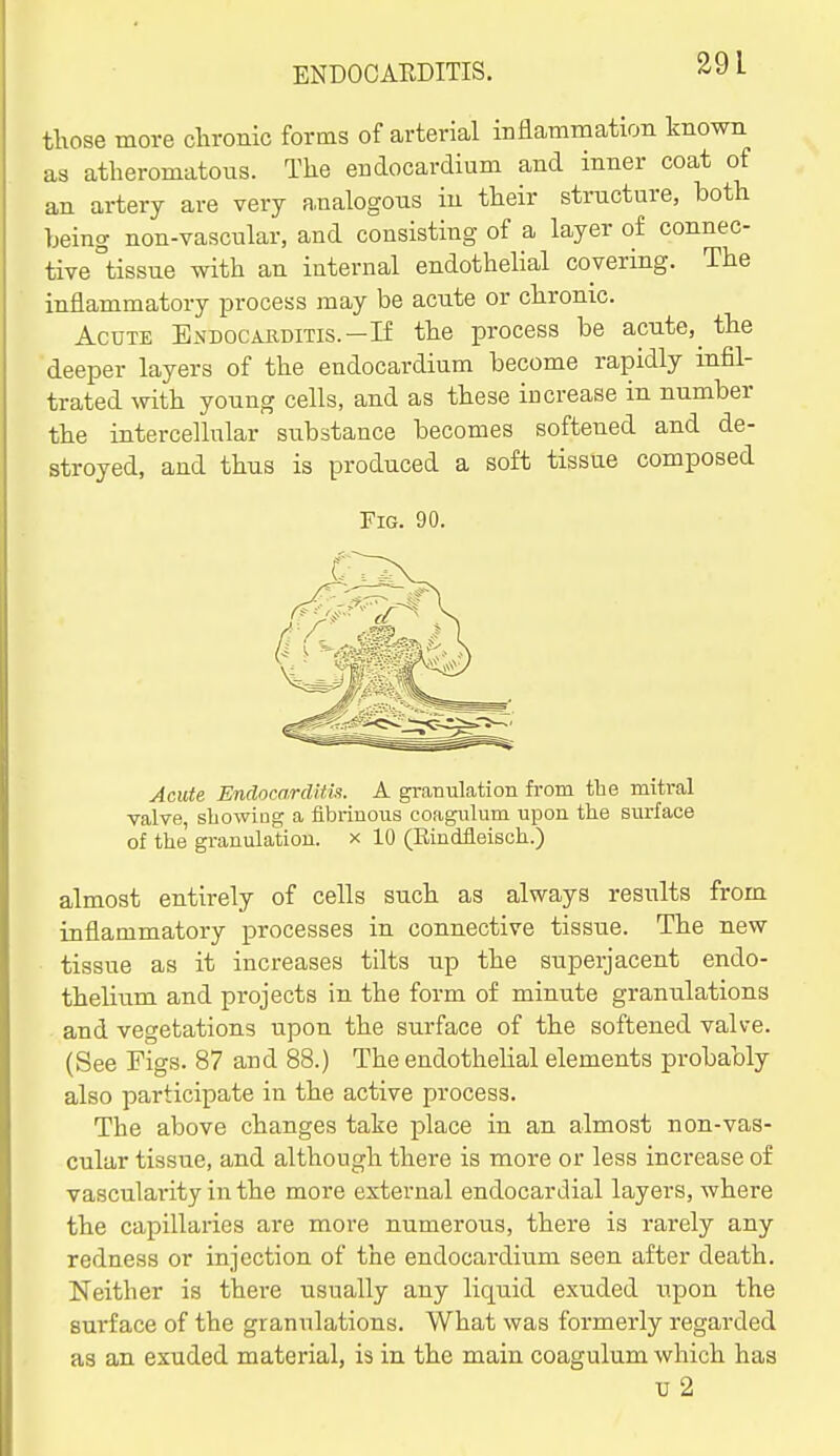 ENDOCARDITIS. those more chronic forms of arterial iDflammation known as atheromatous. The endocardium and inner coat of an artery are very a,nalogous in their structure, both being non-vascular, and consisting of a layer of connec- tive tissue with an internal endothelial covering. The inflammatory process may be acute or chronic. Acute Endocakditis.-If the process be acute, the deeper layers of the endocardium become rapidly infil- trated mth young cells, and as these increase in number the intercellular substance becomes softened and de- stroyed, and thus is produced a soft tissue composed Fig. 90. Acute Endocardia^. A granulation from the mitral valve sbowiug a fibrinous coagulum upon the surface of the granulation, x 10 (Eindfleisch.) almost entirely of cells such as always results from inflammatory processes in connective tissue. The new tissue as it increases tilts up the superjacent endo- thelium and projects in the form of minute granulations and vegetations upon the surface of the softened valve. (See Pigs. 87 and 88.) The endothelial elements probably also participate in the active process. The above changes take place in an almost non-vas- cular tissue, and although there is more or less increase of vasculai-ity in the more external endocardial layers, where the capillaries are more numerous, there is rarely any redness or injection of the endocardium seen after death. Neither is there usually any liquid exuded upon the surface of the granulations. What was formerly regarded as an exuded material, is in the main coagulum which has u 2