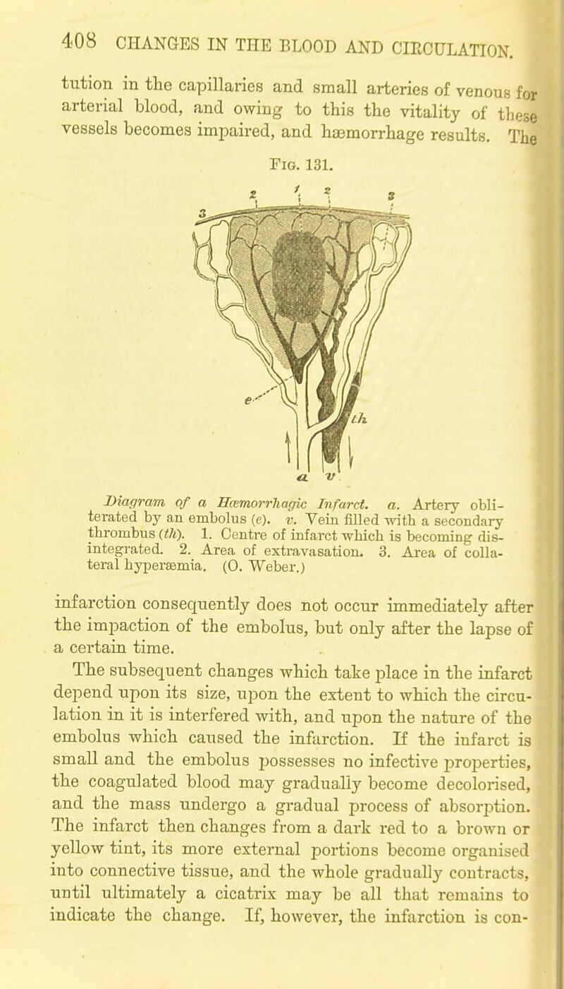 tution in the capillaries and small arteries of venous for arterial blood, and owing to this the vitality of these vessels becomes impaired, and haemorrhage results. The Diagram of a ScBmorrharjic Infarct, a. Artery obli- terated by an embolus (c). v. Vein filled witli a secondary thrombus (ih). 1. Centre of infarct wMcb is becoming dis- integrated. 2. Area of extravasation. 3. Area of colla- teral hypersemia. (0. Weber.) infarction consequently does not occur immediately after the impaction of the embolus, but only after the lapse of a certain time. The subsequent changes which take place in the infarct depend upon its size, upon the extent to which the circu- lation in it is interfered with, and upon the nature of the embolus which caused the infarction. If the infarct is small and the embolus possesses no infective properties, the coagulated blood may gradually become decolorised, and the mass undergo a gradual process of absorption. The infarct then changes from a dark red to a brown or yellow tint, its more external portions become organised into connective tissue, and the whole graduall}'^ contracts, until ultimately a cicatrix may be all that remains to indicate the change. If, however, the infarction is con- FiG. 131. a.