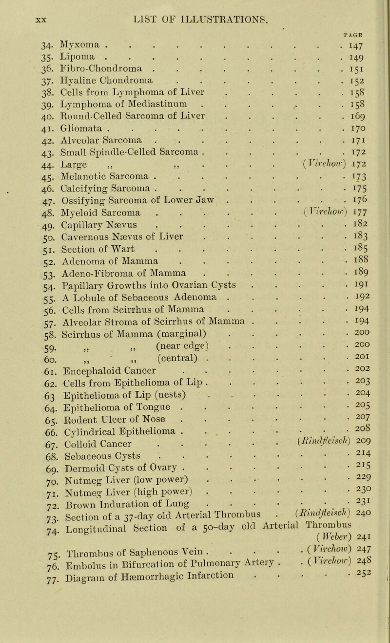 34- 35- 36. 37- 38. 39- 40. 41. 42. 43- 44. 45- 46. 47- 48. 49. 50. 51- 52- 53- 54- 55- 56- 57- 58. 59- 60. 61. 62. 63 64. 65. 66. 67. 68. 69. 70. 7i- 72. 73- 74- 75- 76. 77- Myxoma . Lipoma . Fibro-Chondroma . Hyaline Chondroma Cells from Lymphoma of Live Lymphoma of Mediastinum Round-Celled Sarcoma of Live Gliomata .... Alveolar Sarcoma Small Spindle-Celled Sarcoma Large ,, Melanotic Sarcoma . Calcifying Sarcoma . Ossifying Sarcoma of Lower Jaw Myeloid Sarcoma Capillary Naevus Cavernous Naevus of Liver Section of Wart Adenoma of Mamma Adeno-Fibroma of Mamma Papillary Growths into Ovarian Cysts A Lobule of Sebaceous Adenoma Cells from Scirrhus of Mamma Alveolar Stroma of Scirrhus of Mamma Scirrhus of Mamma (marginal) „ „ (near edge) ,, „ (central) Encephaloid Cancer Cells from Epithelioma of Lip Epithelioma of Lip (nests) Epithelioma of Tongue Rodent Ulcer of Nose Cylindrical Epithelioma Colloid Cancer Sebaceous Cysts Dermoid Cysts of Ovary Nutmeg Liver (low power) Nutmeg Liver (high power) Brown Induration of Lung Section of a 37-day old Arterial Thrombus Longitudinal Section of a 5°~day Thrombus of Saphenous Vein . Embolus in Bifurcation of Pulmonary Artery Diagram of Haemorrhagic Infarction PAGE • 147 • 149 . 151 - 152 - 158 . . 158 . I69 . 170 . 171 . 172 (Virchow) 172 • 173 • 175 . 176 (Virchow) 177 . 182 • - 183 . . 185 . 188 . 189 . 191 . 192 - 194 • 194 . 200 . 200 . 201 . 202 . 203 . 204 • 205 . 207 . 208 (liindfieisch) 209 . 214 . 215 . 229 - 230 • 231 (Rind flench) 240 Arterial Thrombus (Weber) 241 . ( Virchow) 247 ( Virchow) 248 . 252