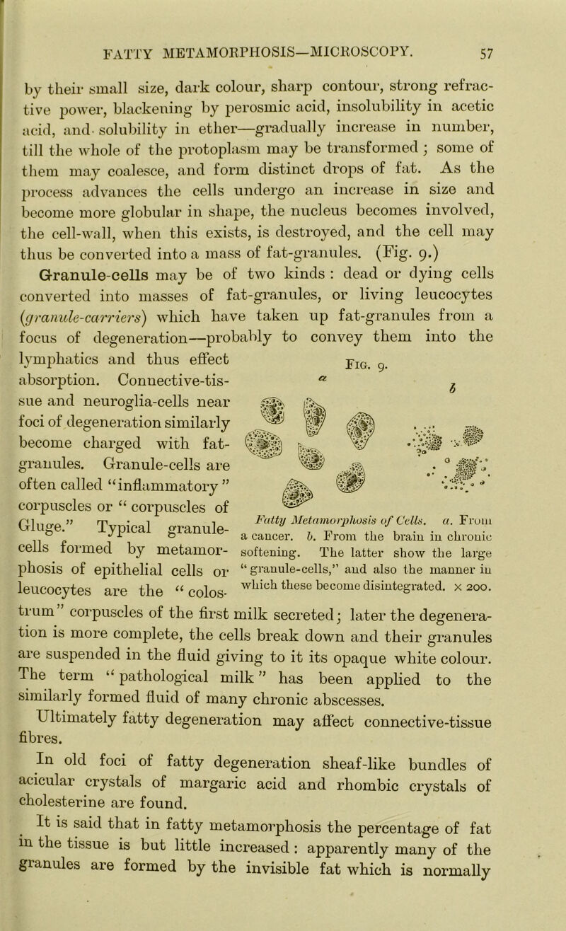 by their small size, dark colour, sharp contour, strong refrac- tive power, blackening by perosmic acid, insolubility in acetic acid, and- solubility in ether—gradually increase in number, till the whole of the protoplasm may be transformed ; some of them may coalesce, and form distinct drops of fat. As the process advances the cells undergo an increase in size and become more globular in shape, the nucleus becomes involved, the cell-wall, when this exists, is destroyed, and the cell may thus be converted into a mass of fat-granules. (Fig. 9.) Granule-cells may be of two kinds : dead or dying cells converted into masses of fat-granules, or living leucocytes (,granule-carriers) which have taken up fat-granules from a focus of degeneration—probably to convey them into the Fig. Ct 30“ lymphatics and thus effect absorption. Connective-tis- sue and neuroglia-cells near foci of degeneration similarly become charged with fat- granules. Granule-cells are often called “inflammatory ” corpuscles or “ corpuscles of Gluge.” Typical granule- cells formed by metamor- phosis of epithelial cells or leucocytes are the “ colos- trum corpuscles of the first milk secreted \ later the degenera- tion is more complete, the cells break down and their granules are suspended in the fluid giving to it its opaque white colour. The term “ pathological milk ” has been applied to the similarly formed fluid of many chronic abscesses. Ultimately fatty degeneration may affect connective-tissue fibres. 0 ■Q04 3 Fatty Metamorphosis of Cells, a. From a cancer, h. From the brain in chronic softening. The latter show the large “ granule-cells,” and also the manner in which these become disintegrated, x 200. In old foci of fatty degeneration sheaf-like bundles of acicular crystals of margaric acid and rhombic crystals of cholesterine are found. It is said that in fatty metamorphosis the percentage of fat in the tissue is but little increased : apparently many of the granules are formed by the invisible fat which is normally