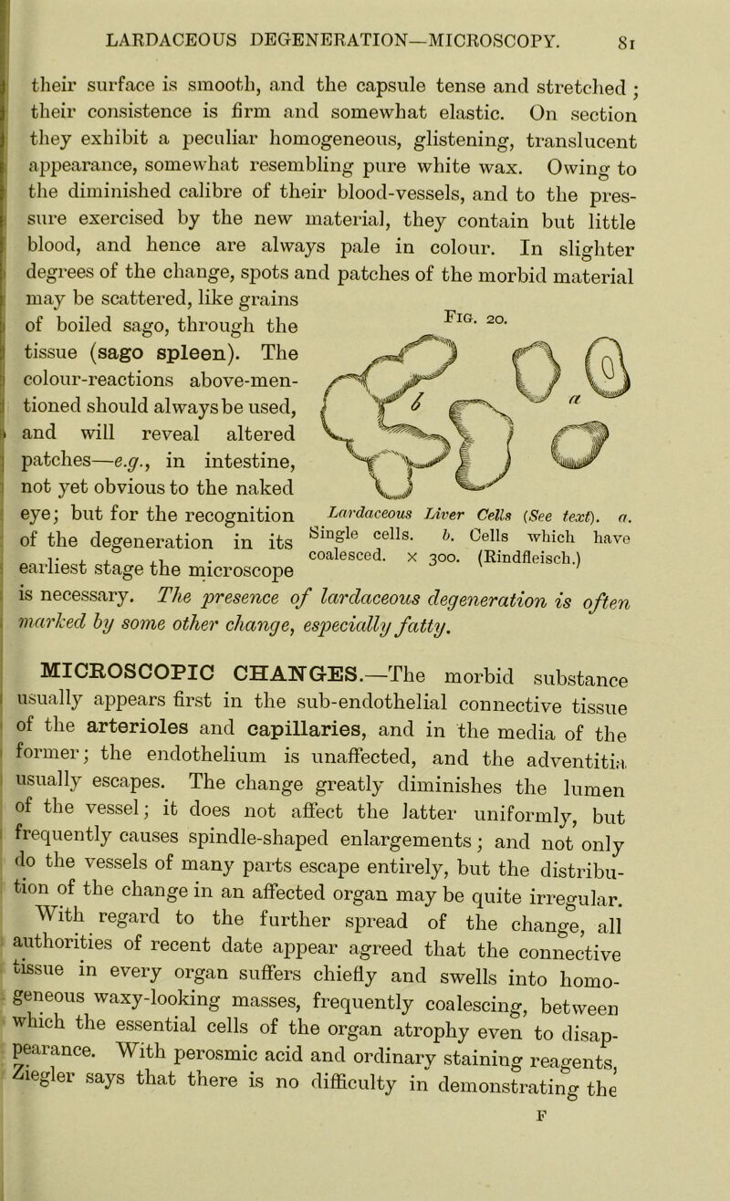 their surface is smooth, and the capsule tense and stretched ; their consistence is firm and somewhat elastic. On section they exhibit a peculiar homogeneous, glistening, translucent appearance, somewhat resembling pure white wax. Owing to the diminished calibre of their blood-vessels, and to the pres- sure exercised by the new material, they contain but little blood, and hence are always pale in colour. In slighter degrees of the change, spots and patches of the morbid material may be scattered, like grains of boiled sago, through the [tissue (sago spleen). The colour-reactions above-men- tioned should always be used, patches—e.g., in intestine, not yet obvious to the naked eye; but for the recognition of the degeneration in its Smfle cells‘ h‘ Cells which have r . , . coalesced, x 300. (Rindfleisch.) earliest stage the microscope 7 is necessary. The 'presence of lardaceous degeneration is often marked by some other change, especially fatty. MICROSCOPIC CHANGES.—The morbid substance usually appears first in the sub-endothelial connective tissue of the arterioles and capillaries, and in the media of the former; the endothelium is unaffected, and the adventitia usually escapes. The change greatly diminishes the lumen of the vessel; it does not affect the latter uniformly, but frequently causes spindle-shaped enlargements; and not only do the vessels of many parts escape entirely, but the distribu- tion of the change in an affected organ may be quite irregular. With regard to the further spread of the change, all authorities of recent date appear agreed that the connective tissue in every organ suffers chiefly and swells into homo- geneous waxy-looking masses, frequently coalescing, between ■ which the essential cells of the organ atrophy even to disap- pearance. With perosmic acid and ordinary staining reagents legler says that there is no difficulty in demonstrating the F Fig. 20.