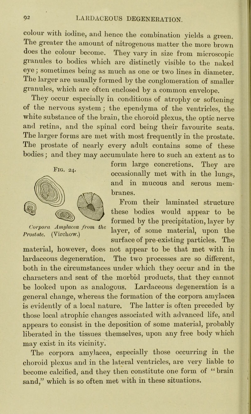 Fig. 24. colour with iodine, and hence the combination yields a green. Ihe greater the amount of nitrogenous matter the more brown does the colour become. They vary in size from microscopic granules to bodies which are distinctly visible to the naked eye; sometimes being as much as one or two lines in diameter. The larger are usually formed by the conglomeration of smaller granules, which are often enclosed by a common envelope. They occur especially in conditions of atrophy or softening of the nervous system; the ependyma of the ventricles, the white substance of the brain, the choroid plexus, the optic nerve and retina, and the spinal cord being their favourite seats. The larger forms are met with most frequently in the prostate. The prostate of nearly every adult contains some of these bodies; and they may accumulate here to such an extent as to form large concretions. They are occasionally met with in the lungs, and in mucous and serous mem- branes. From their laminated structure these bodies would appear to be formed by the precipitation, layer by layer, of some material, upon the surface of pre-existing particles. The material, however, does not appear to be that met with in lardaceous degeneration. The two processes are so different, both in the circumstances under which they occur and in the characters and seat of the morbid products, that they cannot be looked upon as analogous. Lardaceous degeneration is a general change, whereas the formation of the corpora amylacea is evidently of a local nature. The latter is often preceded by those local atrophic changes associated with advanced life, and appears to consist in the deposition of some material, probably liberated in the tissues themselves, upon any free body which may exist in its vicinity. The corpora amylacea, especially those occurring in the choroid plexus and in the lateral ventricles, are very liable to become calcified, and they then constitute one form of “brain sand,” which is so often met with in these situations. Corpora Amylacea from the Prostate. (Virchow.)