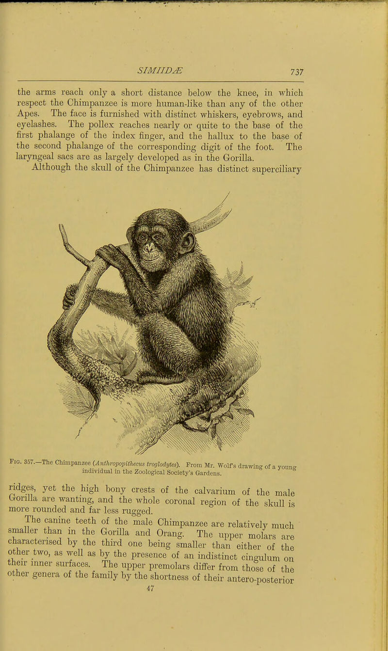 tlie arms reach only a short distance below the knee, in which respect the Chimpanzee is more human-like than any of the other Apes. The face is furnished \nth distinct whiskers, eyebrows, and eyelashes. The pollex reaches nearly or quite to the base of the first phalange of the index finger, and the hallux to the base of the second phalange of the corresponding digit of the foot. The laryngeal sacs are as largely developed as in the Gorilla. Although the skull of the Chimpanzee has distinct superciliary rio. 35r.-The Chimpanzee (Anthropopithecus troglodytes). From Mr. Wolfs drawing of a young- individual in tlie Zoological Society's Gardens. ridges, yet the high bony crests of the calvarium of the male tronlla are wanting, and the whole coronal region of the skull is more rounded and far less rugged. The canine teeth of the male Chimpanzee are relatively much smaller than m the Gorilla and Orang. The upper molars are characterised by the third one being smaller than either of the other two, as well as by the presence of an indistinct cingulum on their inner surfaces. The upper premolars differ from those of the other genera of the family by the shortness of their antero-posterior 47